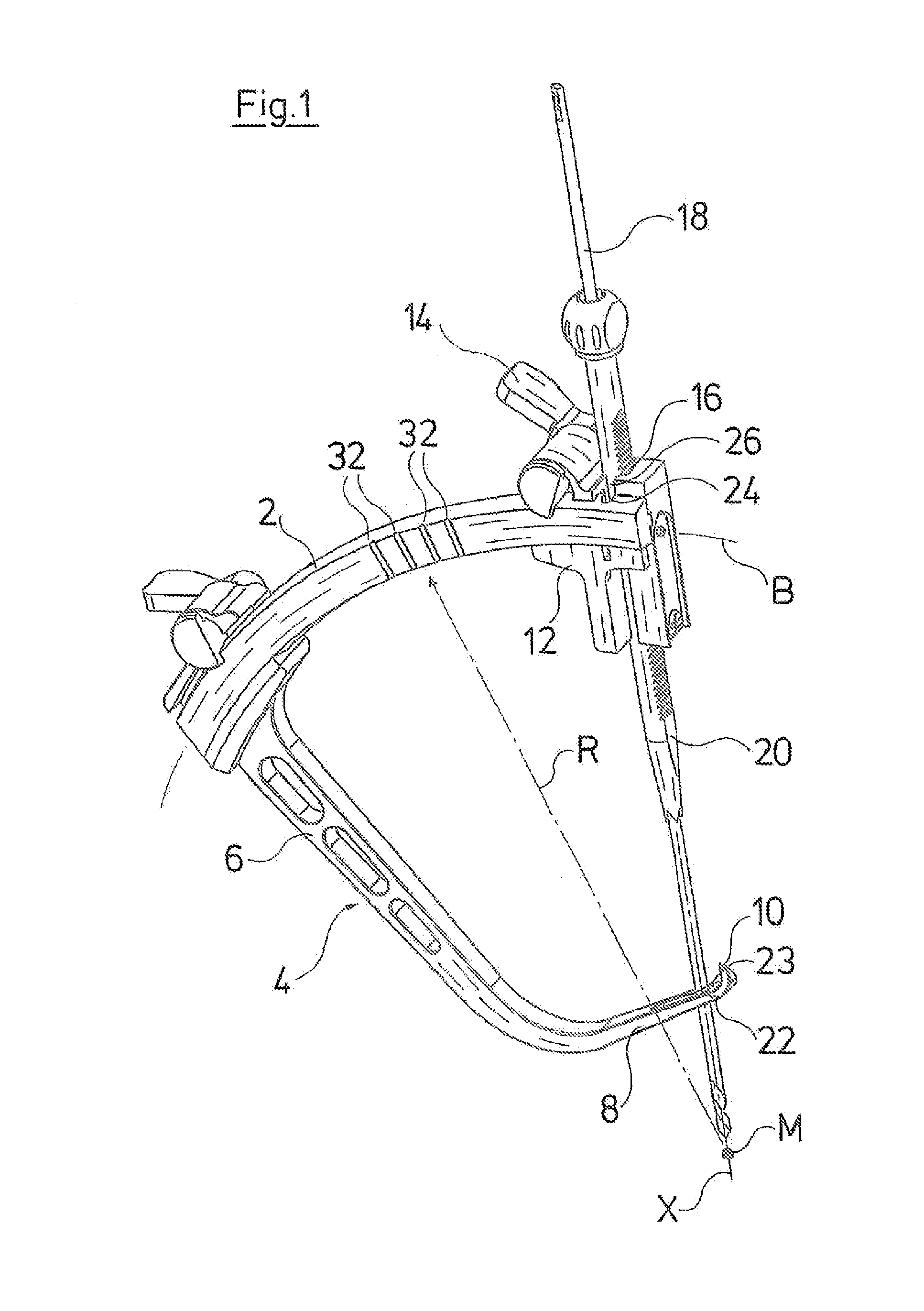 Surgical guiding device for reconstruction of anterior cruciate ligament