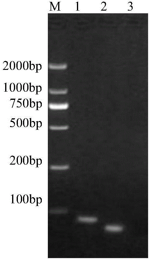 Bovine rotavirus VP8* subunit recombinant chimeric protein and application thereof