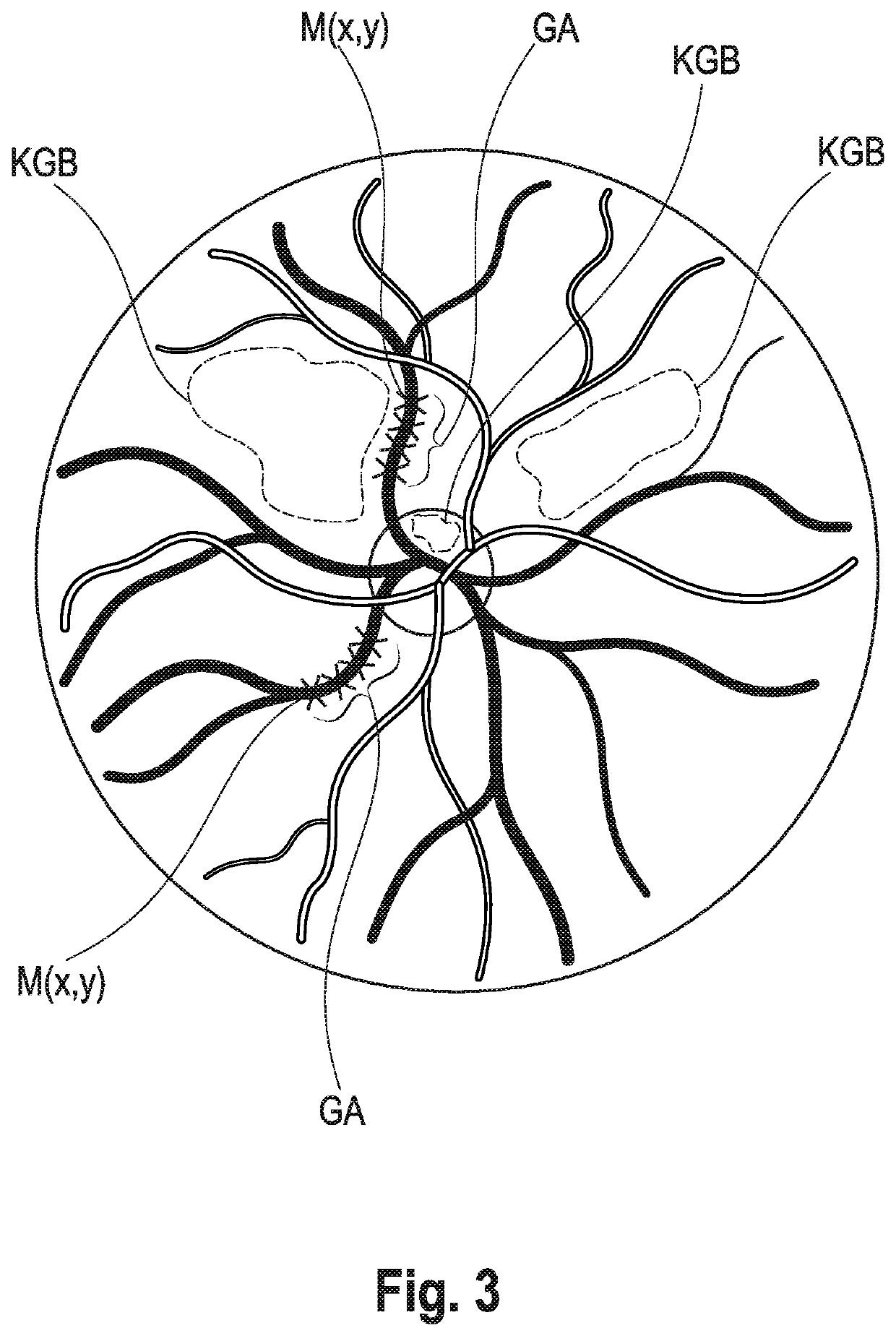 Method and Device for Examining the Neurovascular Coupling at the Eye of a Patient