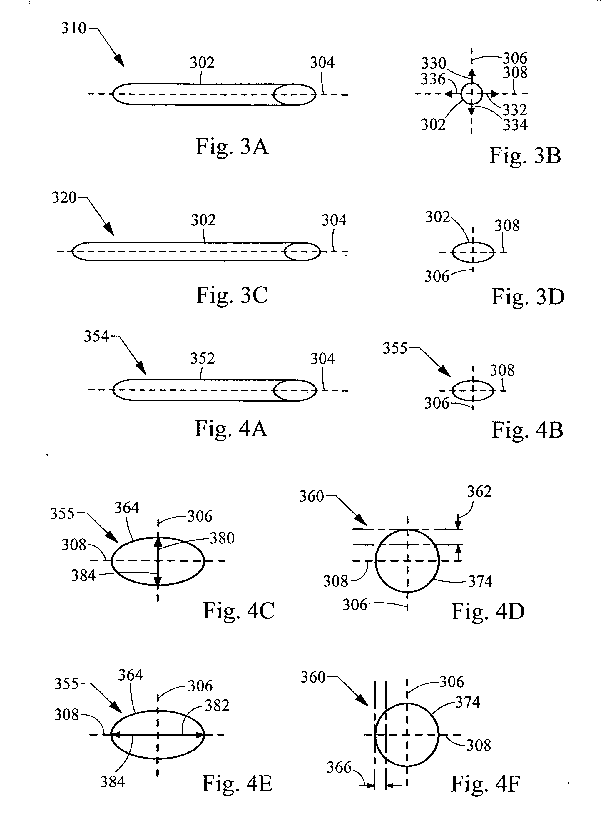 Implantable medical device with optimized shape