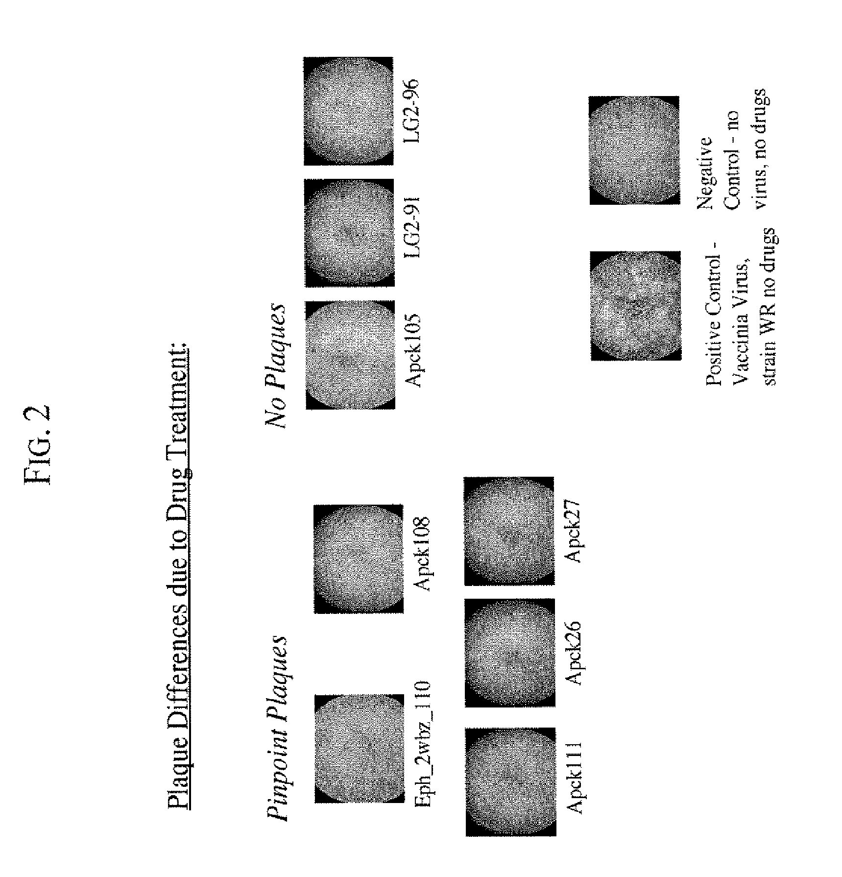 Kinase Inhibitors for Preventing or Treating Pathogen Infection and Method of Use Thereof