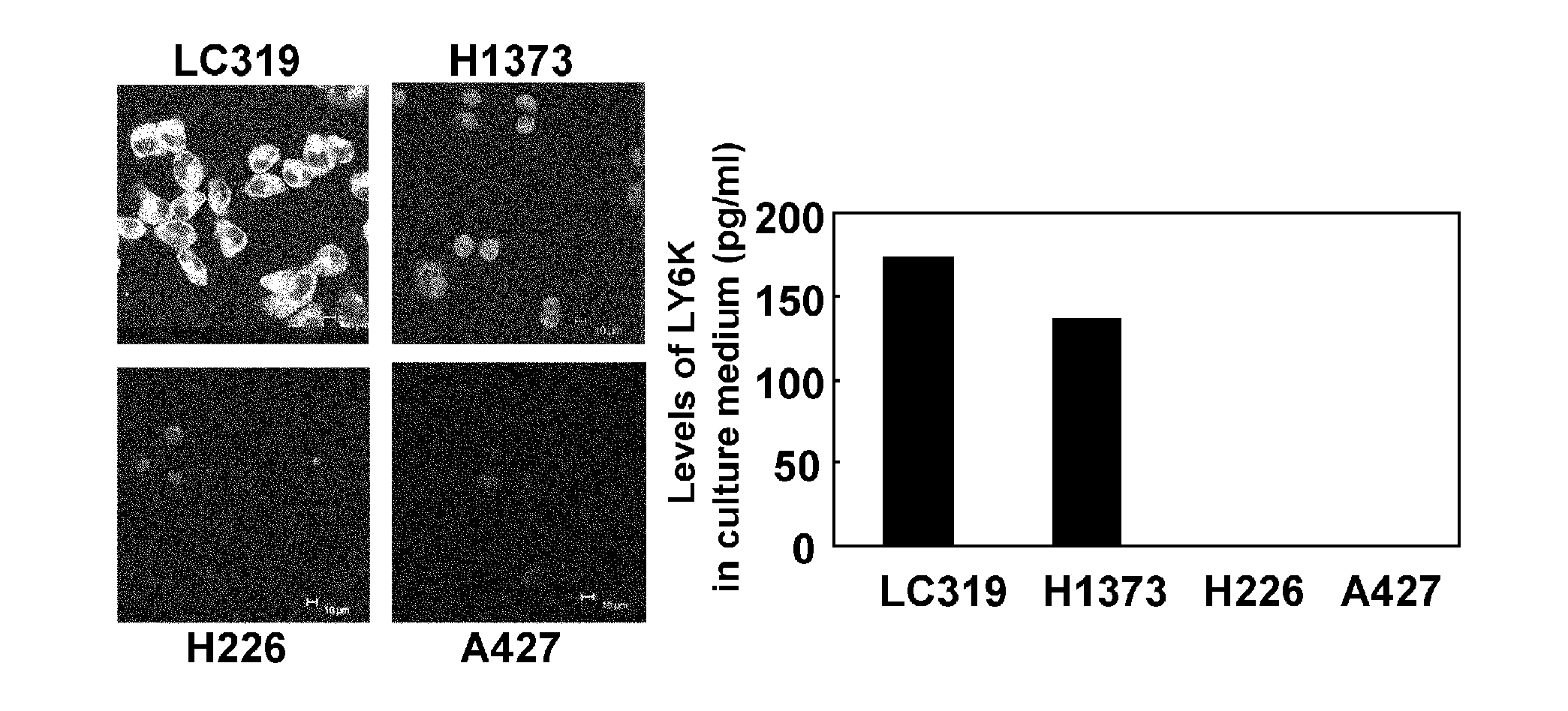 Cancer associated gene ly6k