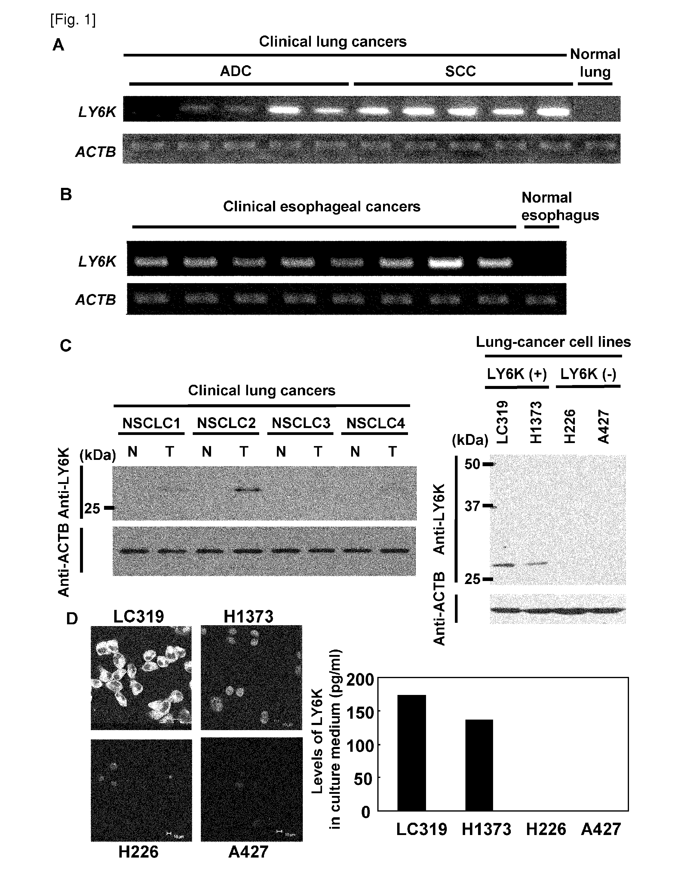 Cancer associated gene ly6k