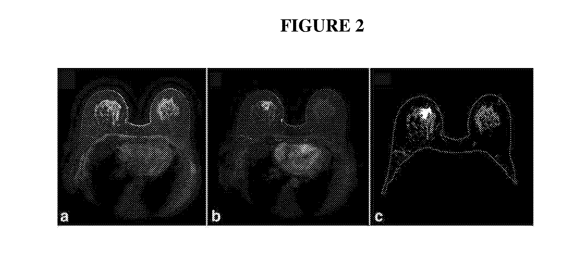 Systems and methods for extracting prognostic image features