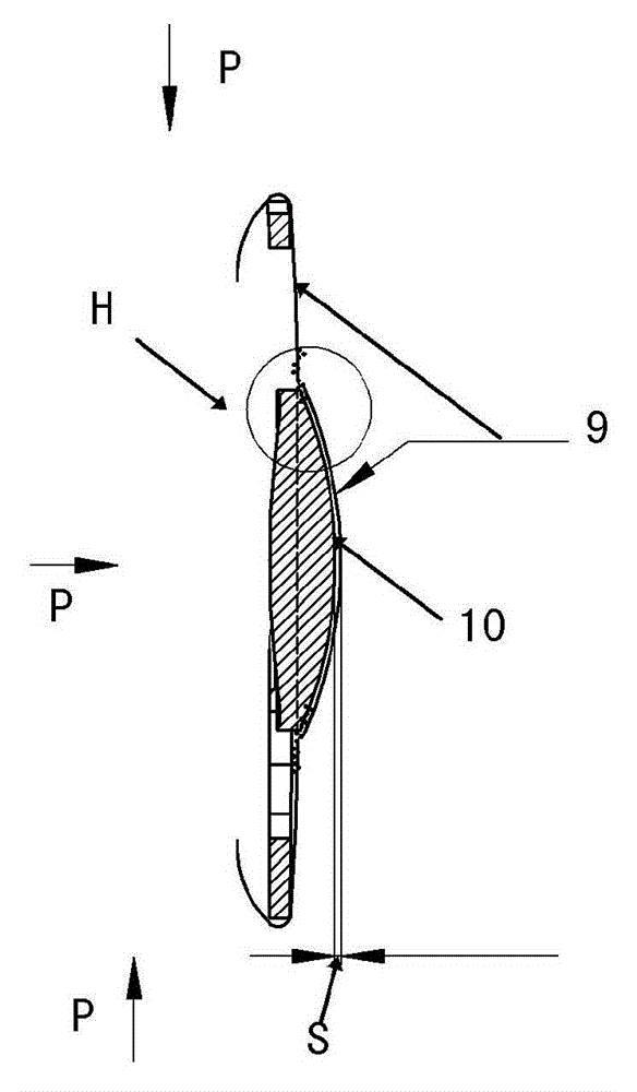 posterior chamber intraocular lens