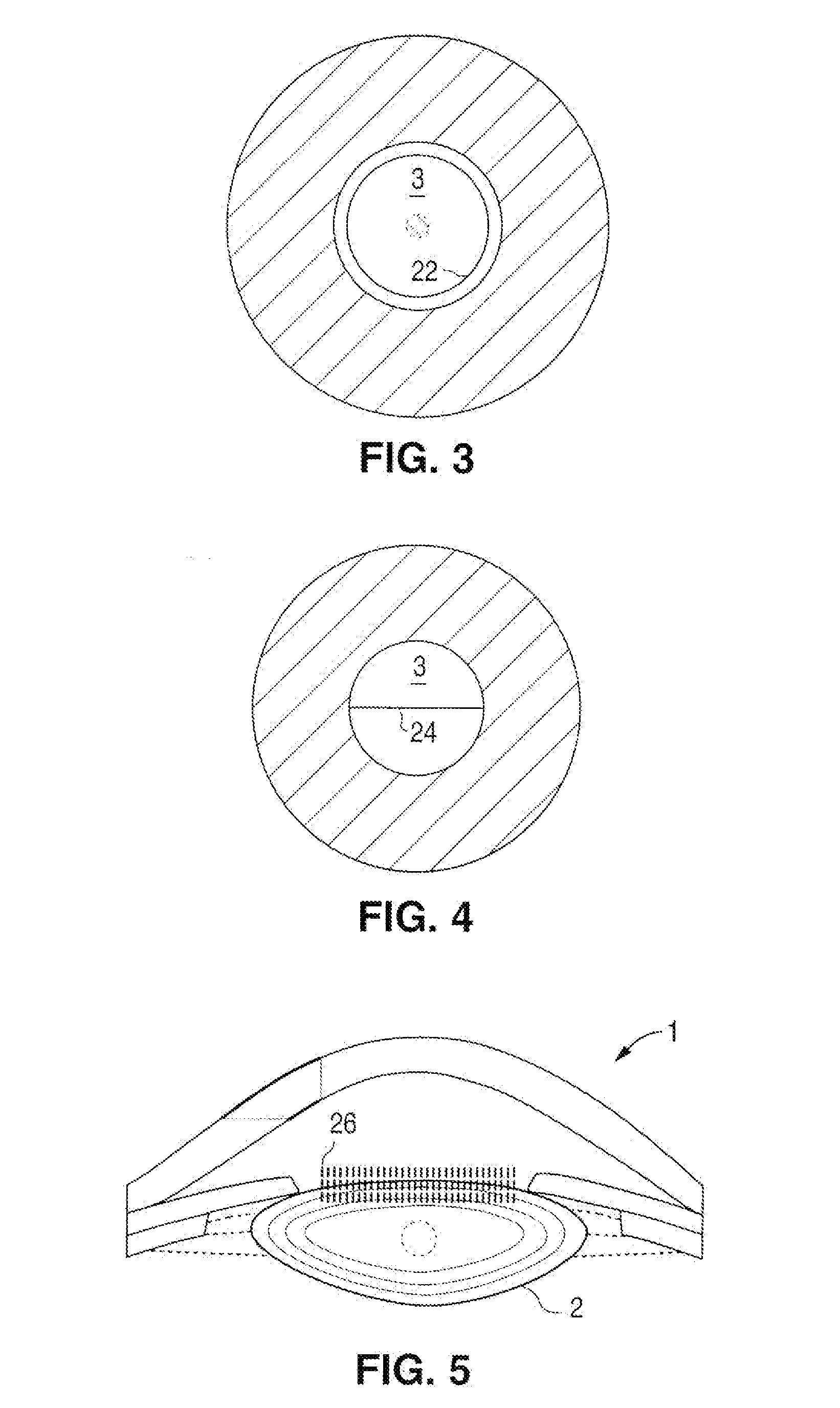 Method Of Patterned Plasma-Mediated Laser Trephination Of The Lens Capsule And Three Dimensional Phaco-Segmentation