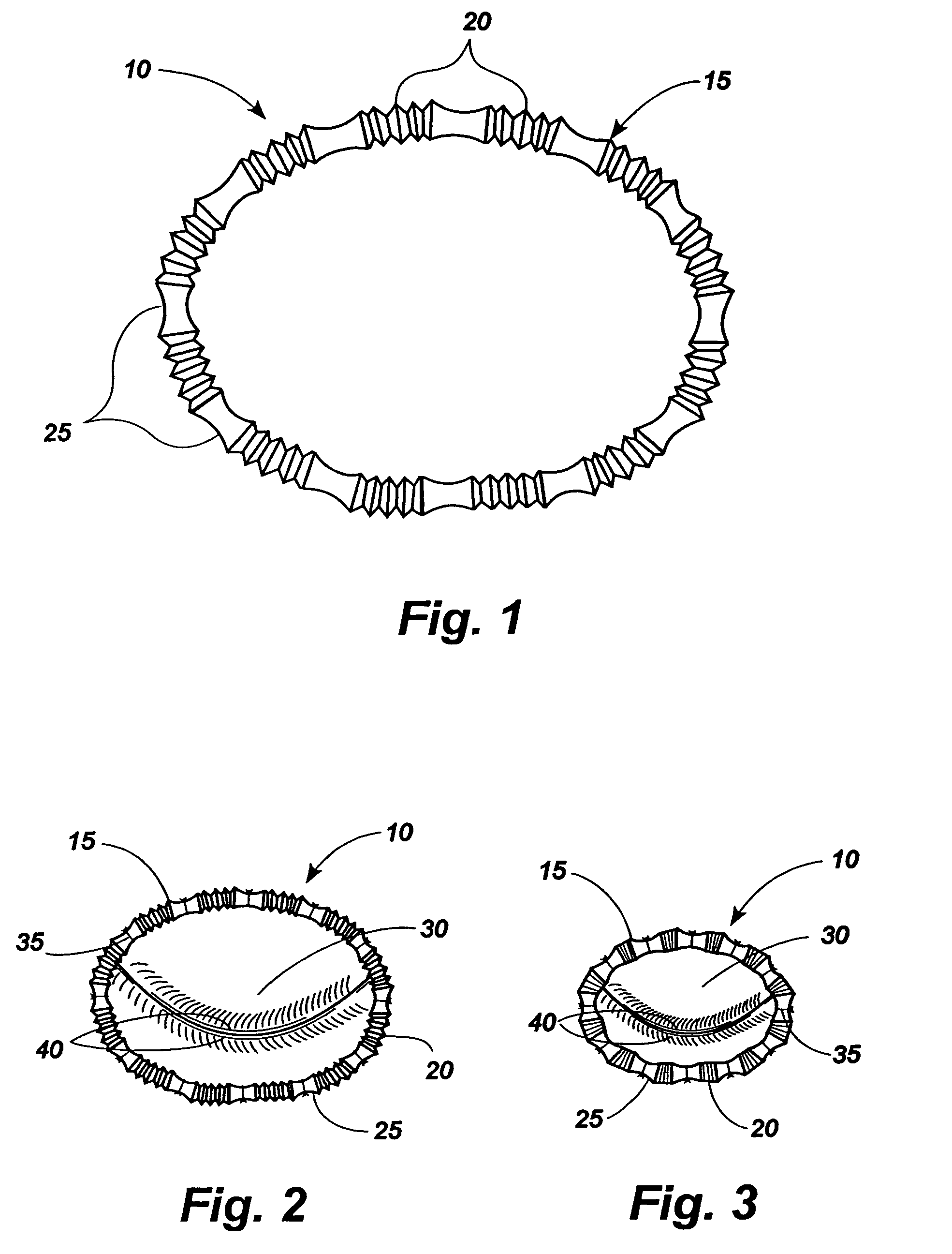 Apparatus for implanting surgical devices for controlling the internal circumference of an anatomic orifice or lumen