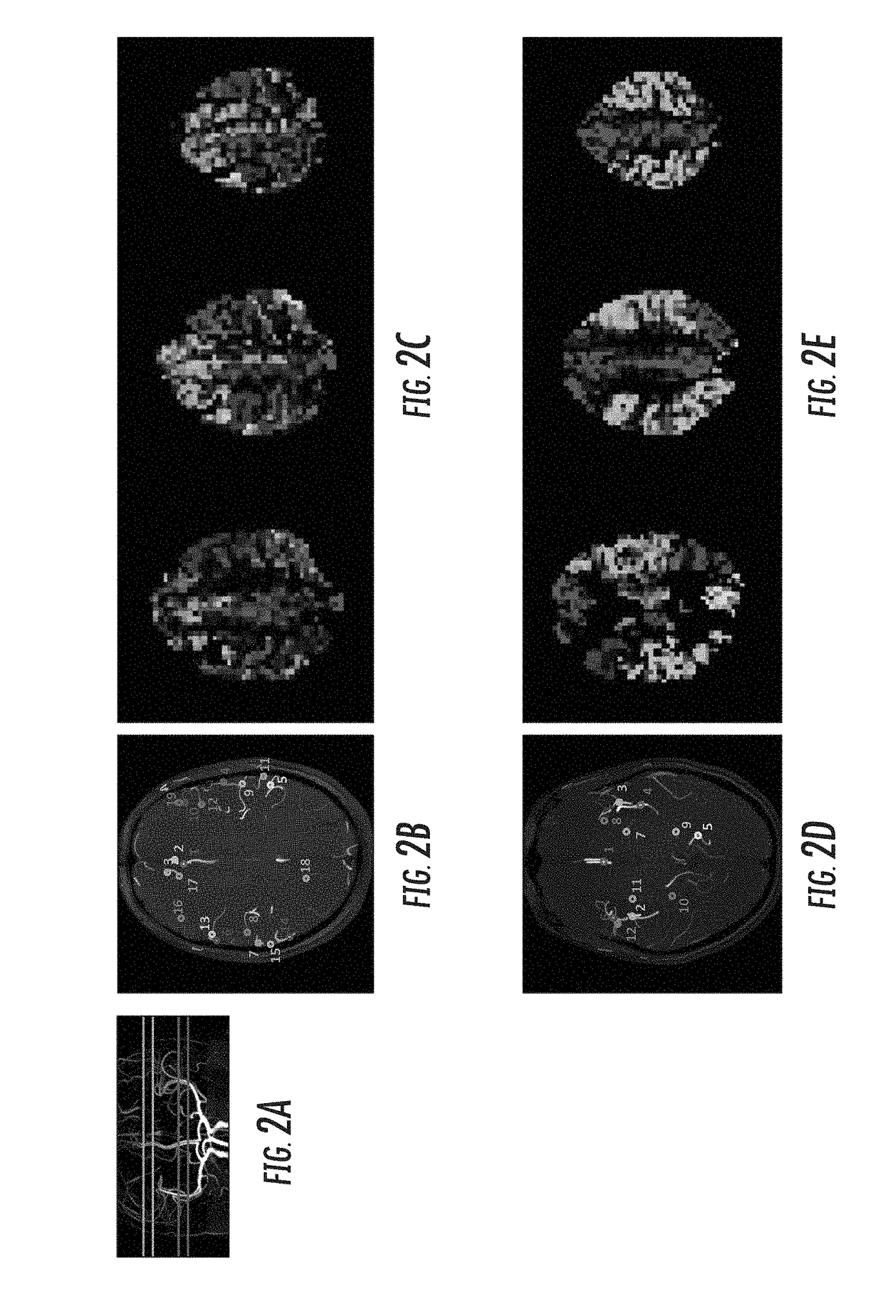 Vascular territory segmentation using mutual clustering information from image space and label space