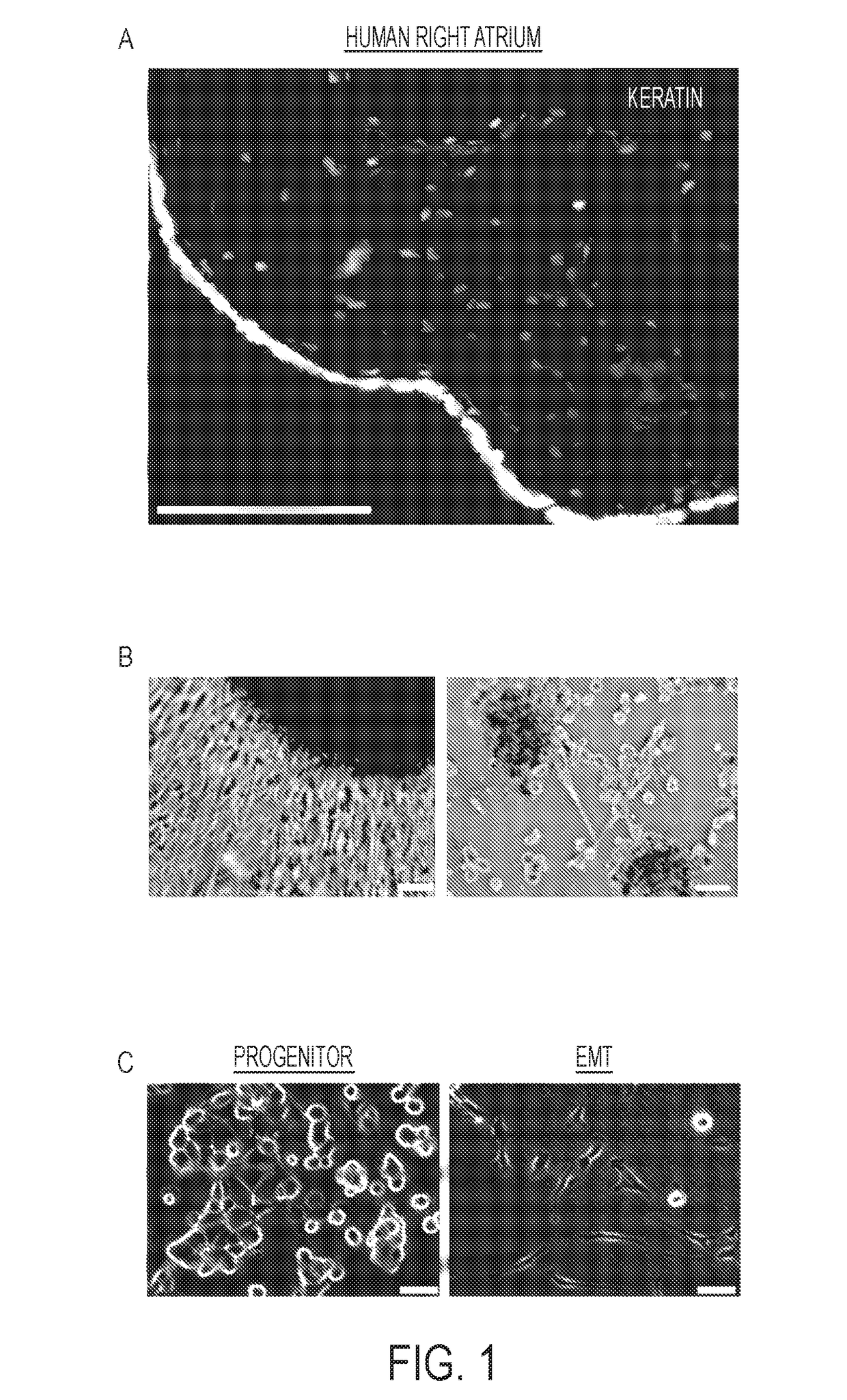 Compositions and Methods for Vascular Protection Against Reperfusion Injury After Myocardial Ischemia