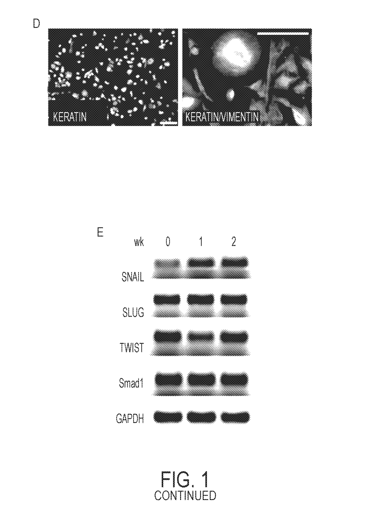 Compositions and Methods for Vascular Protection Against Reperfusion Injury After Myocardial Ischemia