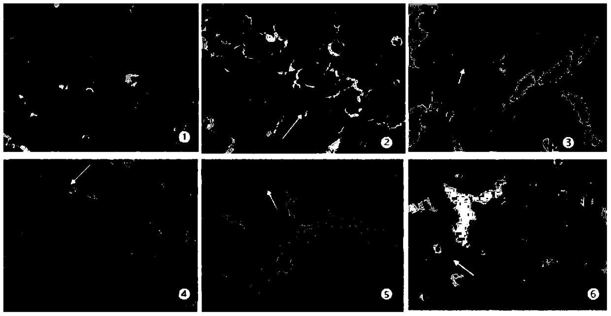 A kind of pharmaceutical composition for treating diabetic encephalopathy and its preparation method and application