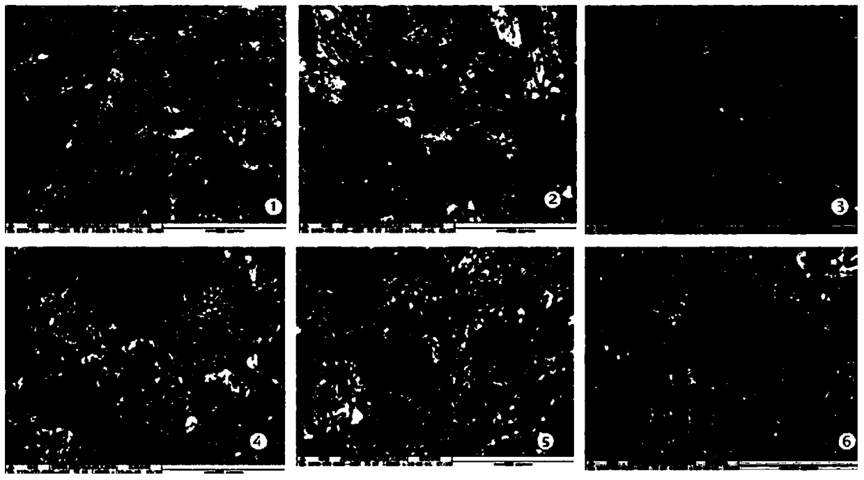 A kind of pharmaceutical composition for treating diabetic encephalopathy and its preparation method and application