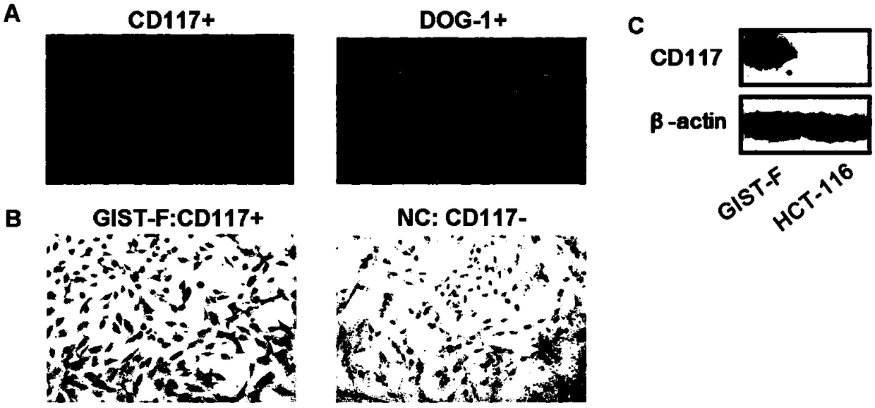 Imatinib-drug-resistance KIT and PDGFRA wild type GIST cell strain and establishment method and application thereof