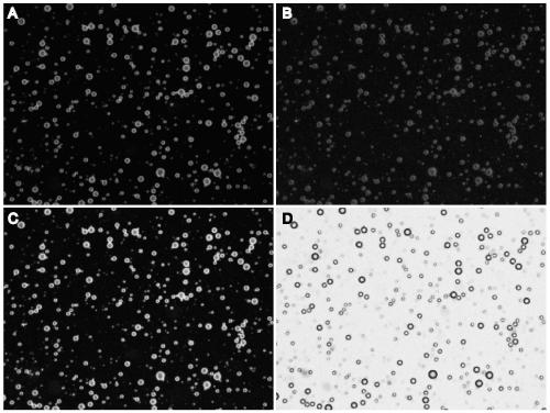 Bionic lipid microbubble ultrasonic contrast agent constructed by cell membranes and preparation method of contrast agent