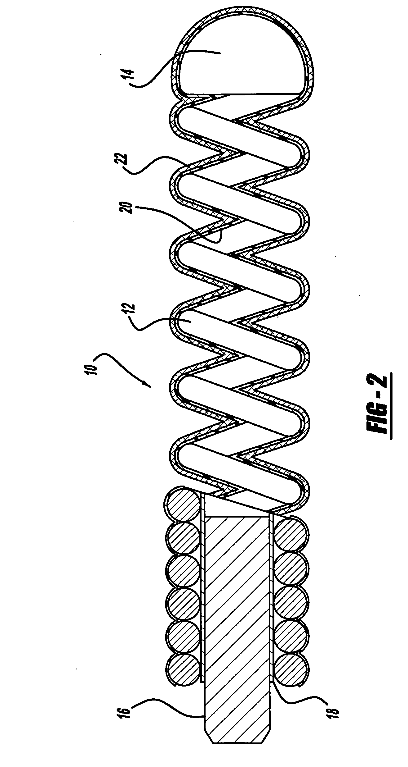 Activatable foam expandable implantable medical device and method of use