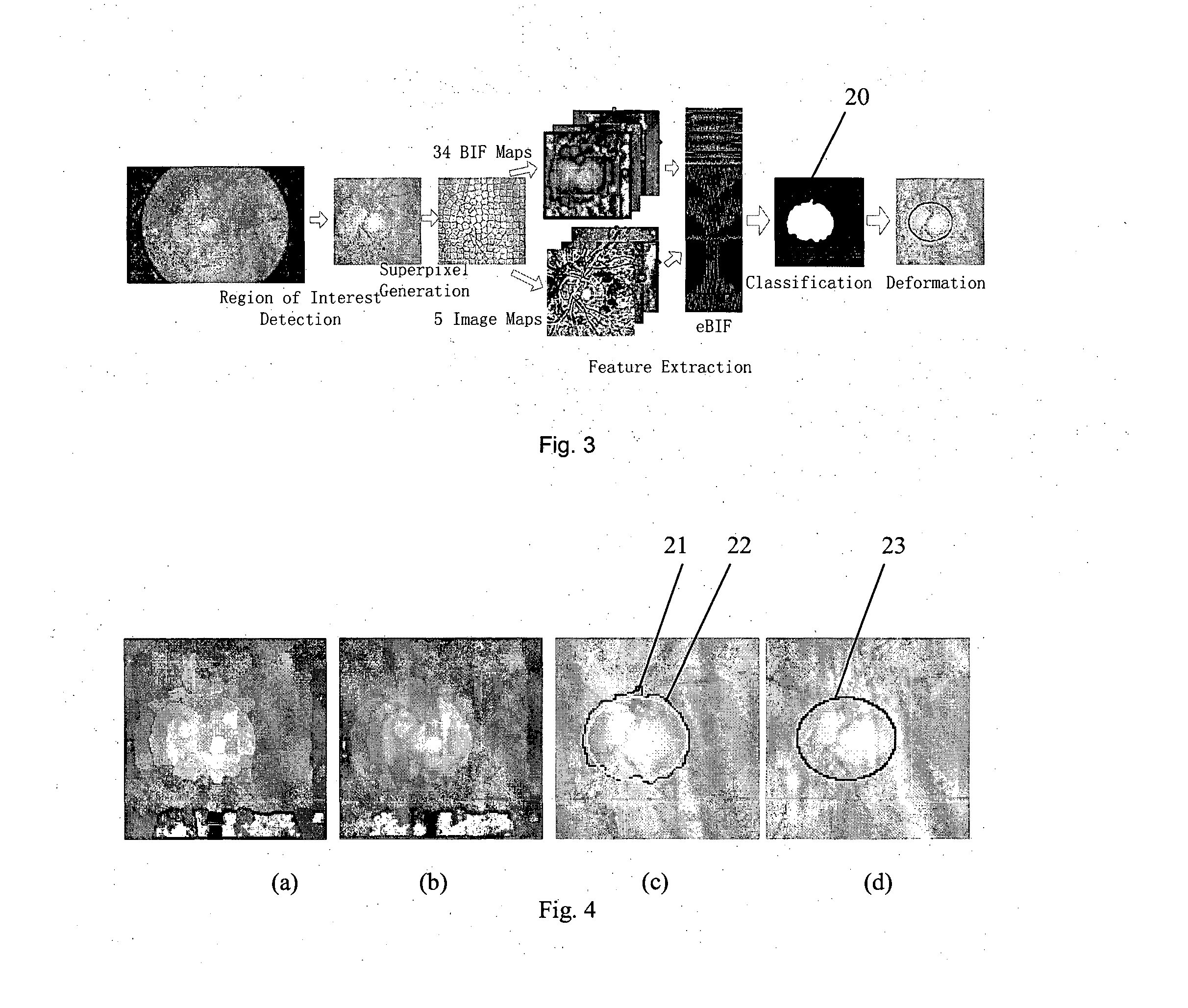 Methods and systems for automatic location of optic structures in an image of an eye, and for automatic retina cup-to-disc ratio computation