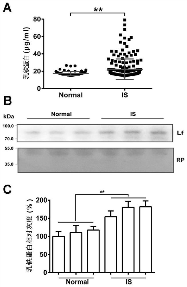 Application of the substance for detecting or regulating the expression level of lactoferrin in the preparation of drugs or kits for preventing and/or treating cardiovascular and cerebrovascular diseases