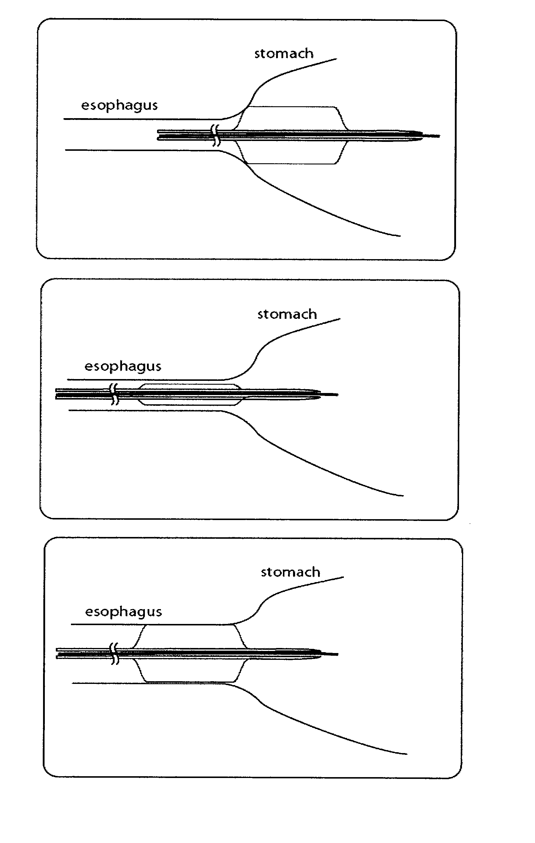 Methods and systems for optical imaging or epithelial luminal organs by beam scanning thereof