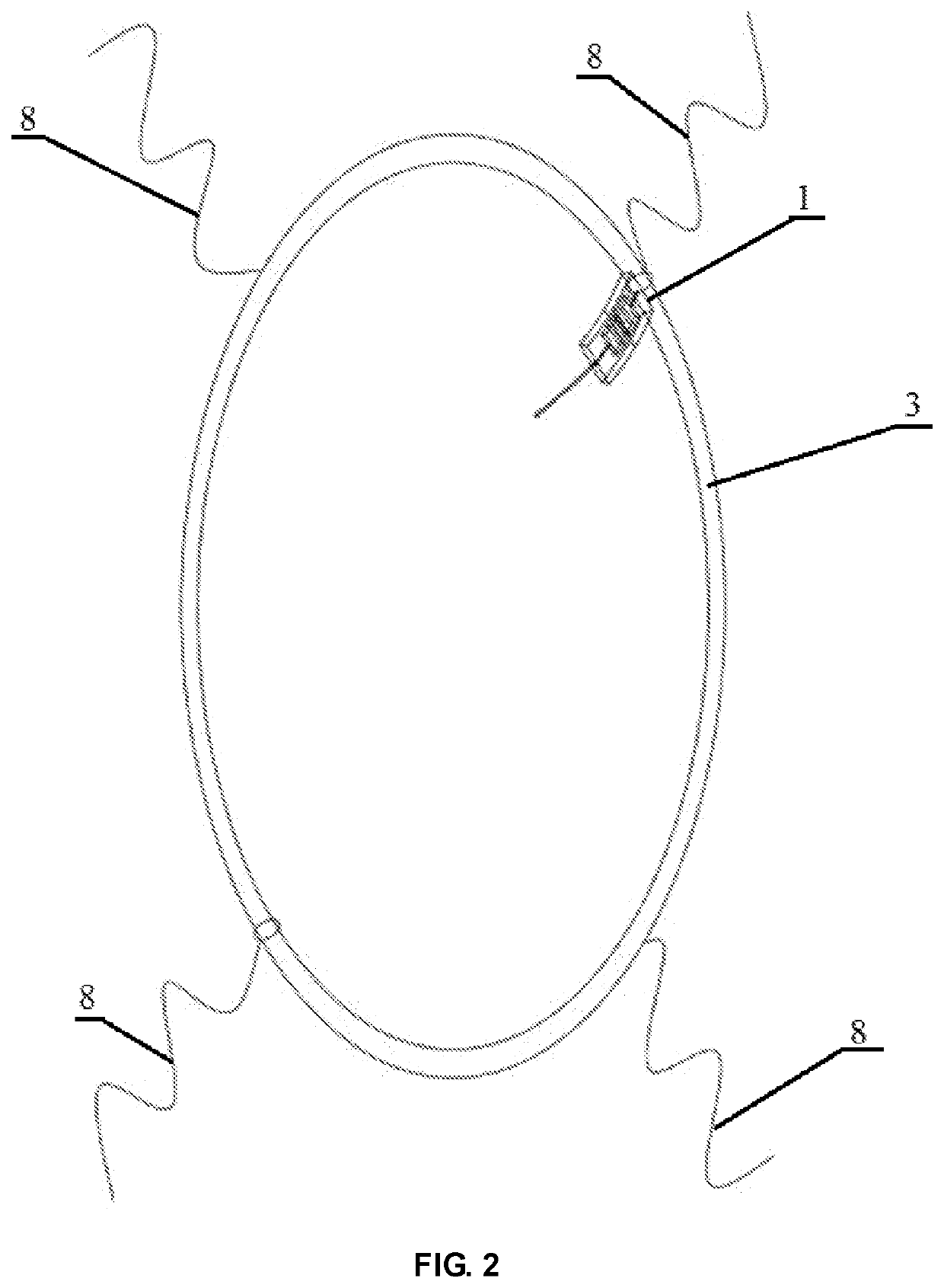 Glaucoma aqueous humor drainage device and glaucoma aqueous humor drainage method