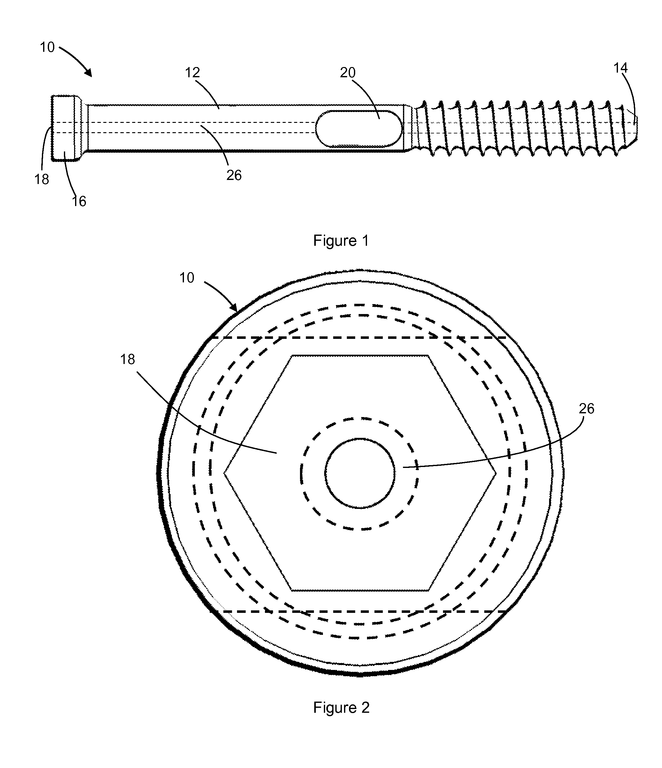 Bone screw fixation system