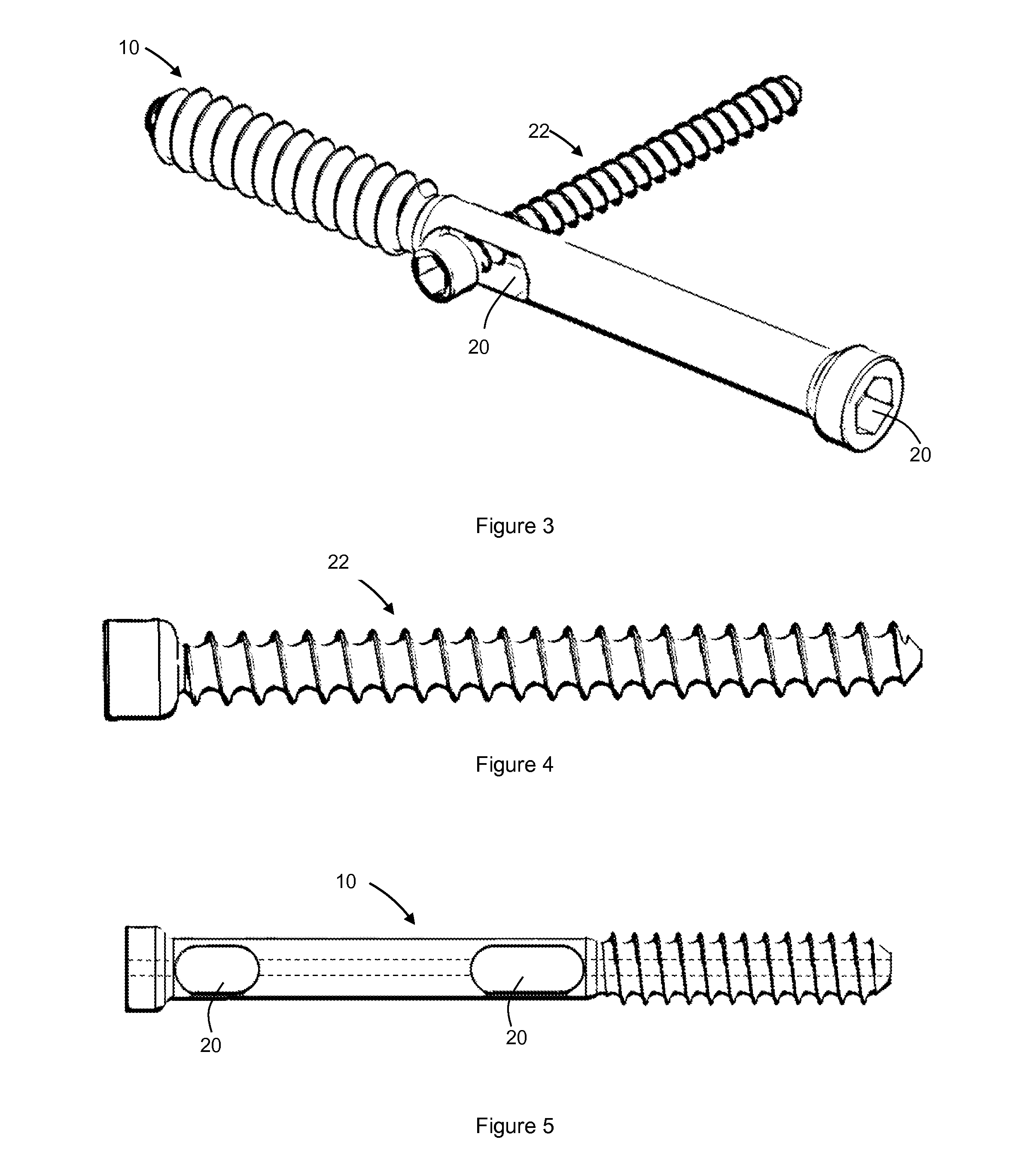 Bone screw fixation system