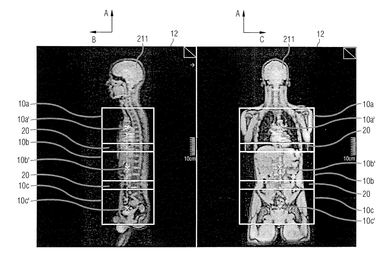 Magnetic resonance imaging method and apparatus