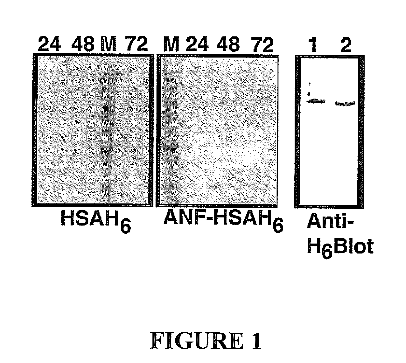 Anf analogue