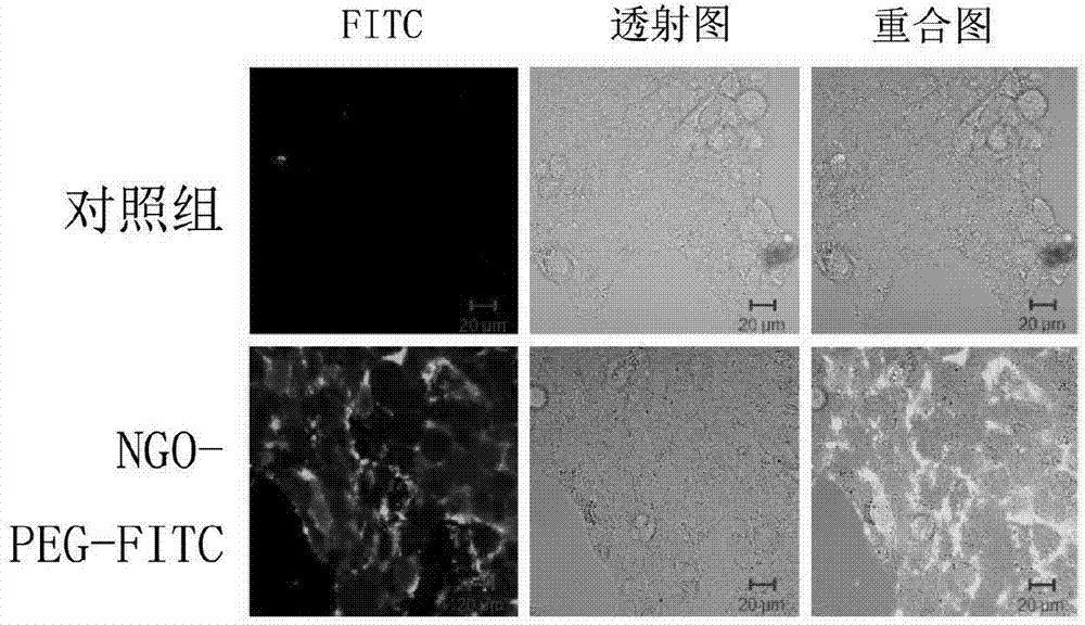 Nanometer drug complex loaded with paclitaxel and preparation method thereof