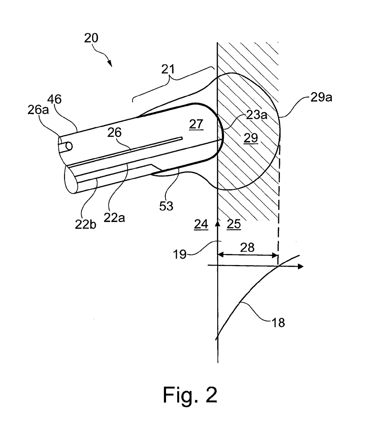 Ablation catheter device with electrodes for detecting an electric response of biological material