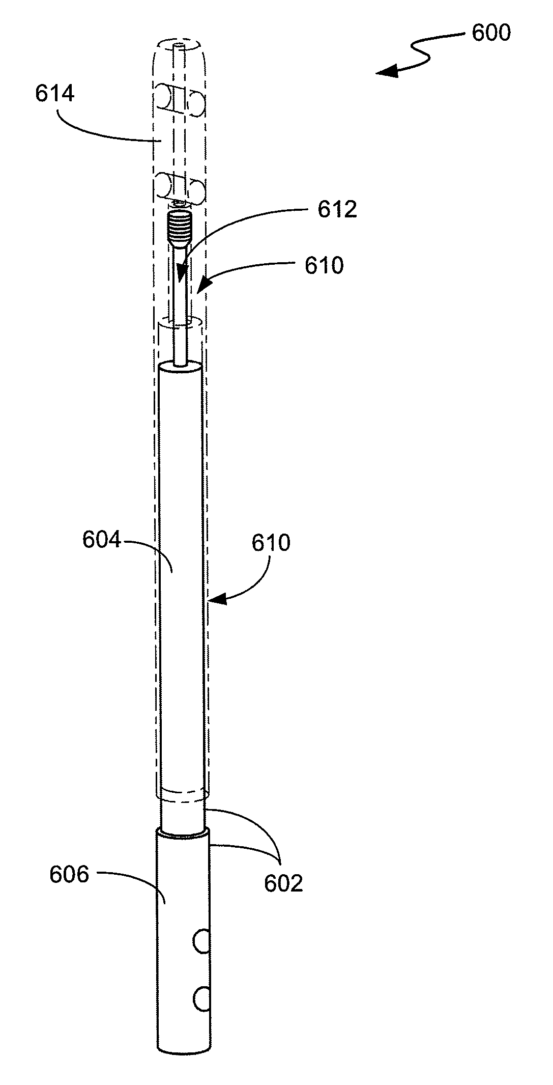 Intramedullary medical device and methods of use and manufacture