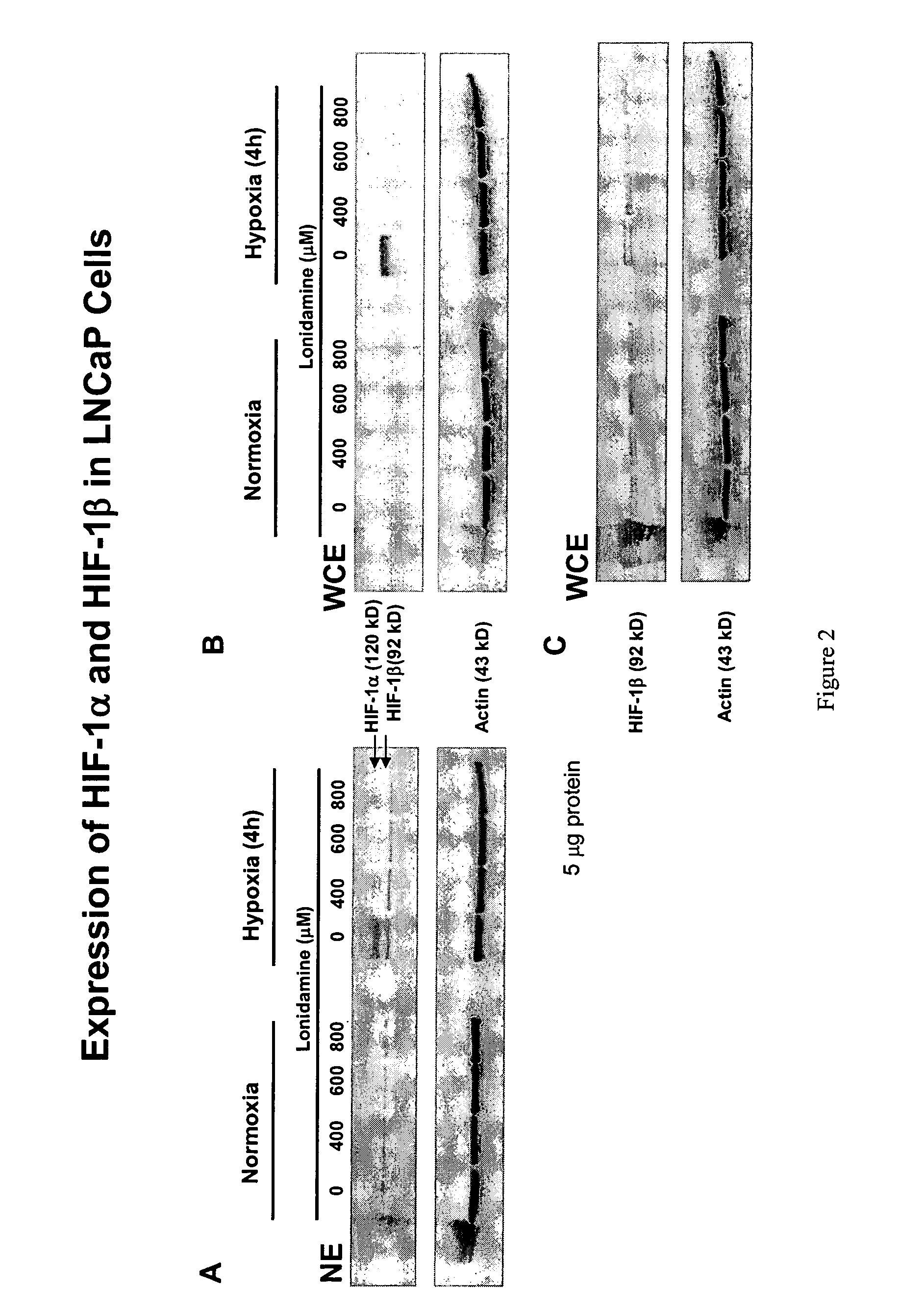 Treatment of benign prostatic hyperplasia