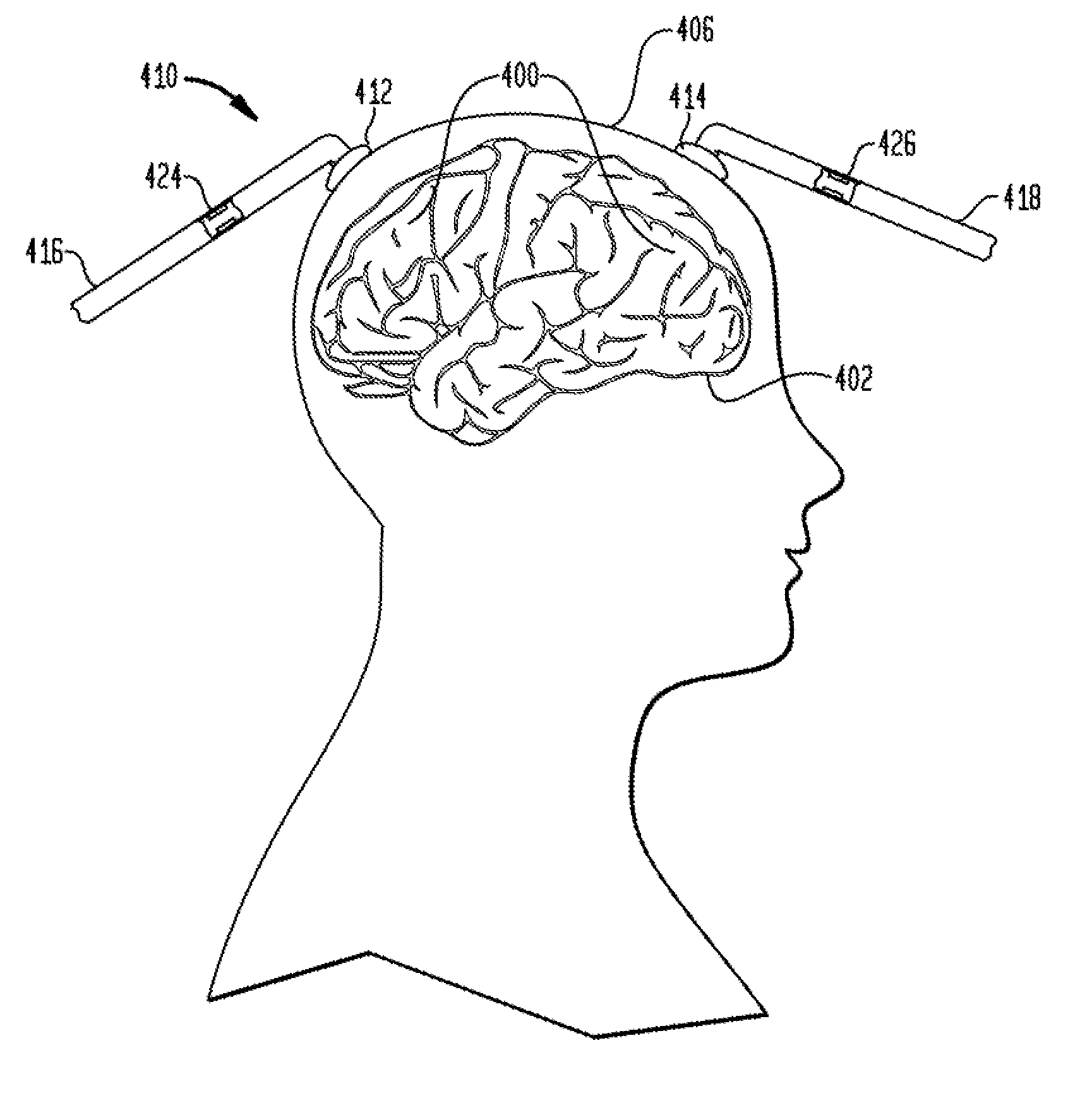 Methods and apparatus for transcranial stimulation