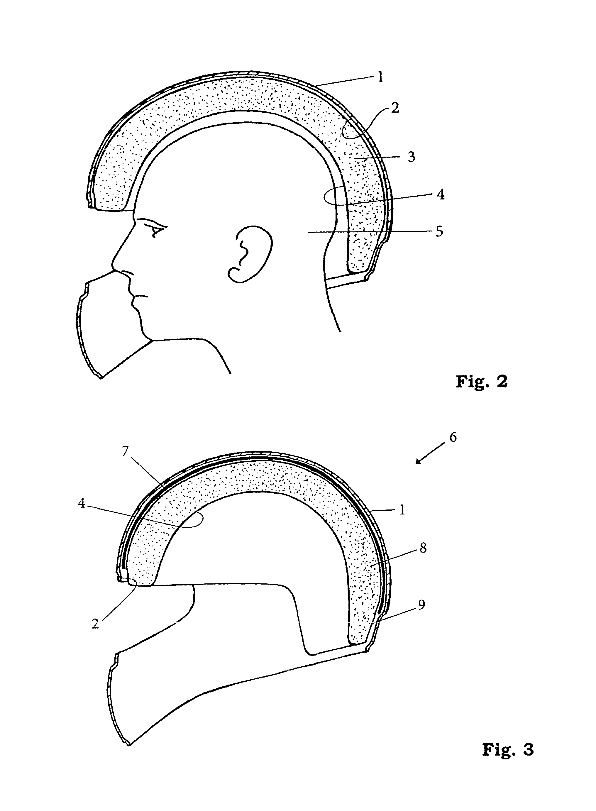 Protective helmet; method for reducing or preventing a head injury