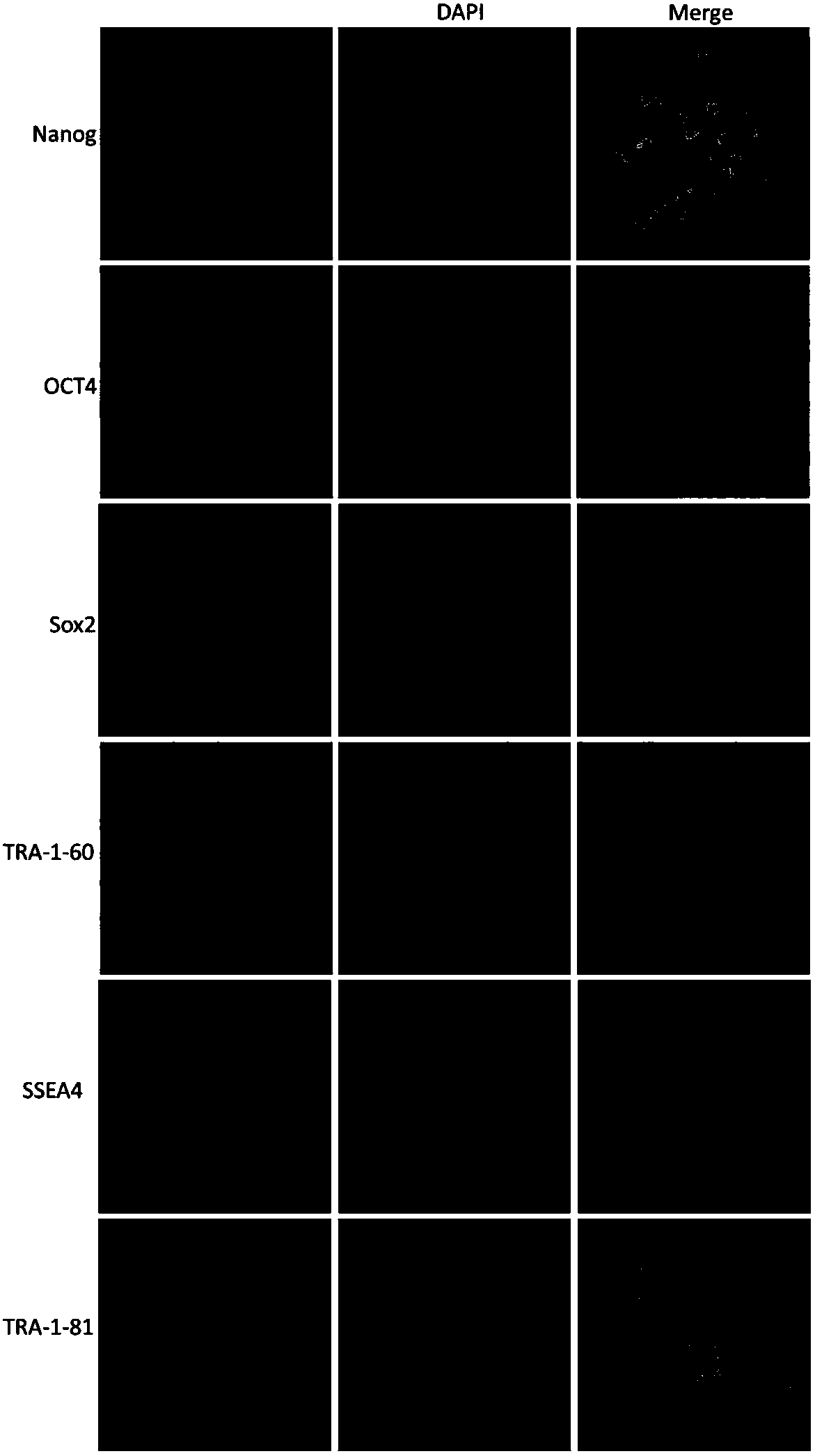 Multipotential stem cell-derived mesoderm pedigree mesenchymal stem cell and preparation method thereof