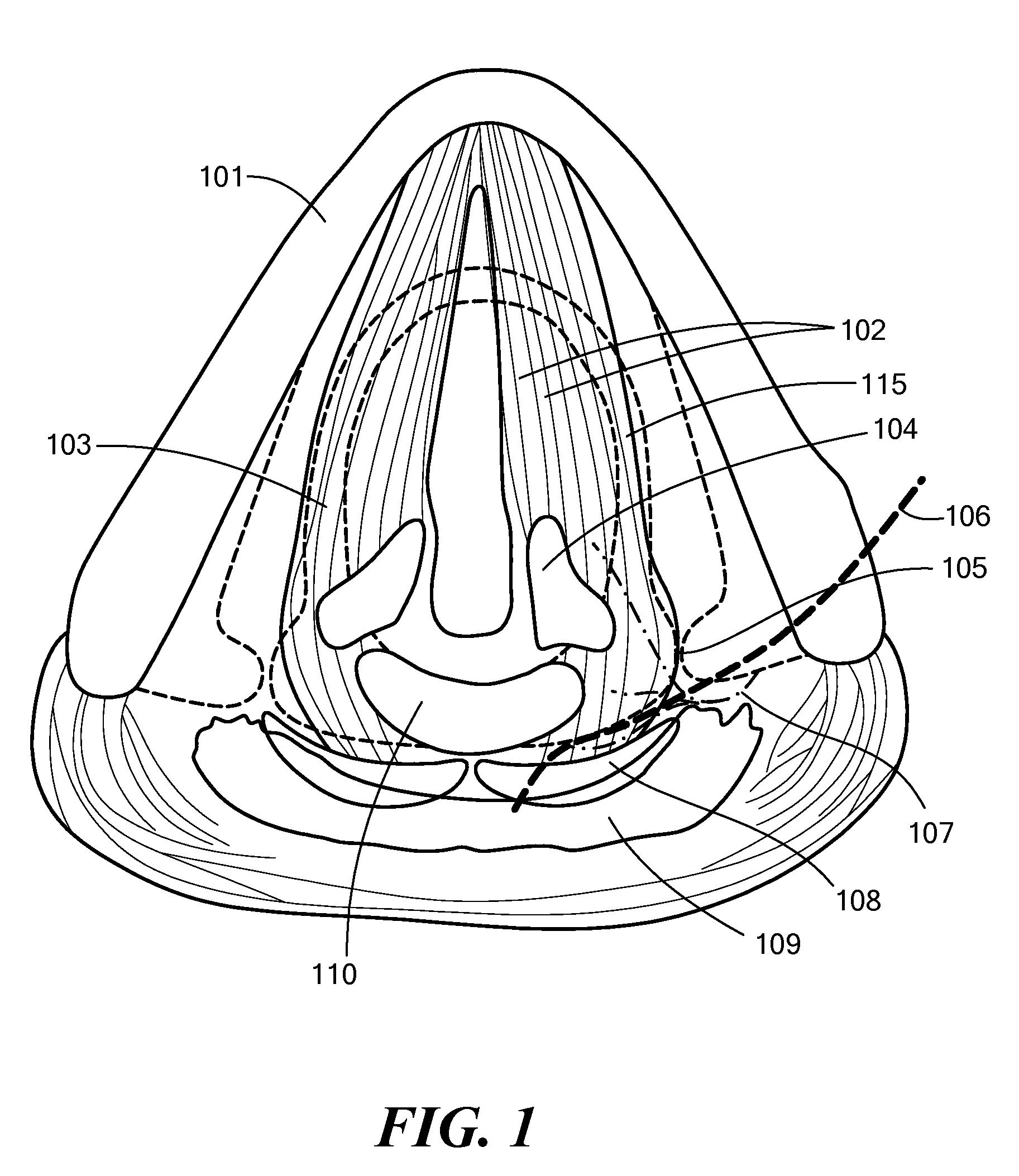 System, Apparatus, and Method for Facilitating Interface with Laryngeal Structures
