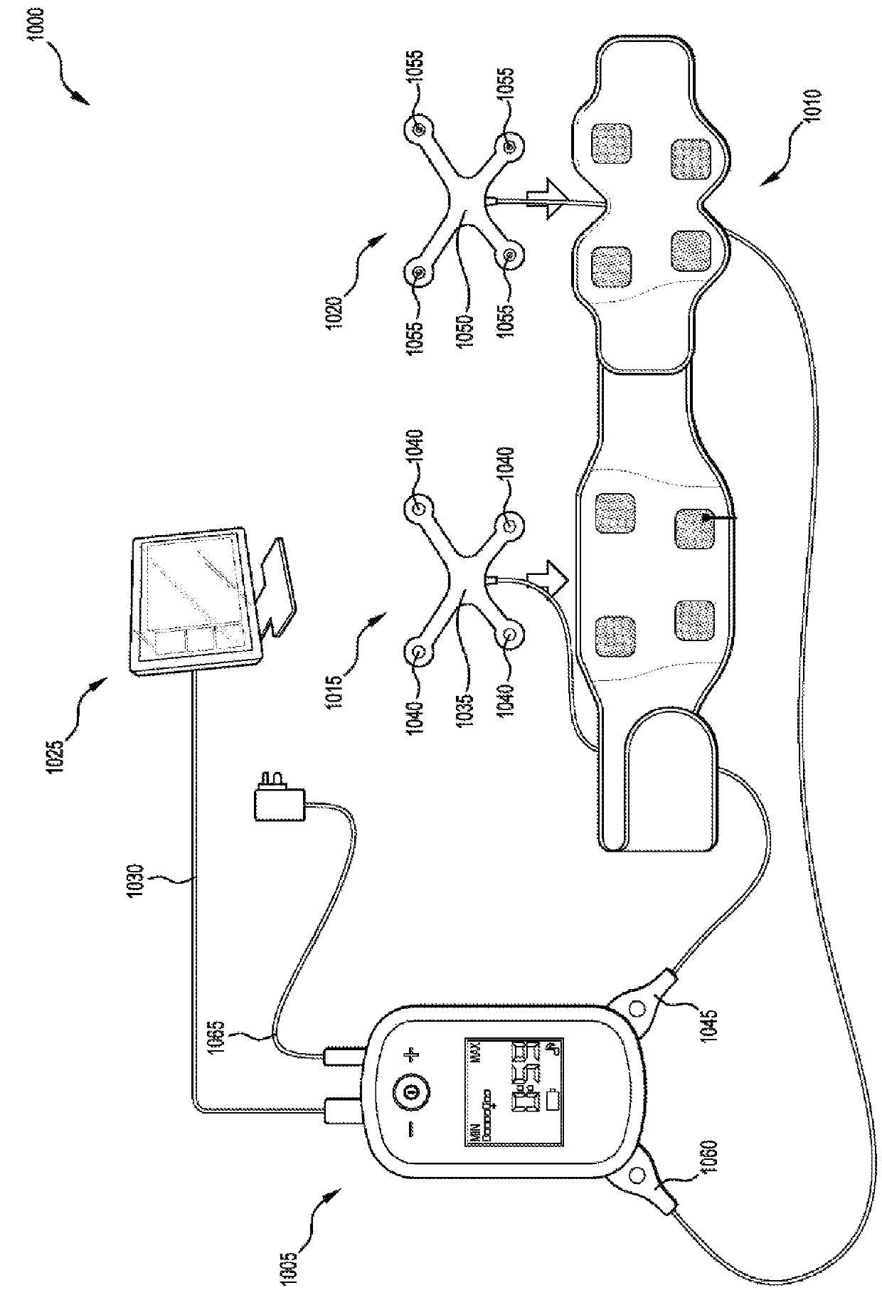 System, device and garment for delivering transcutaneous electrical stimulation
