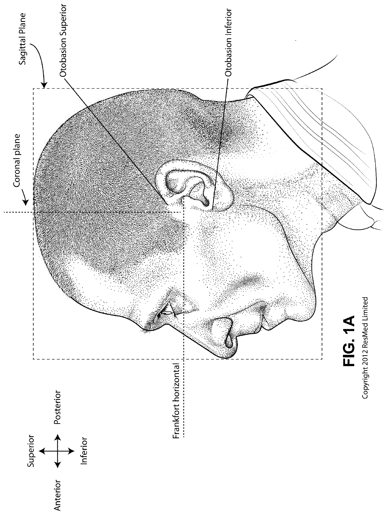 Positioning and stabilising structure and system incorporating same