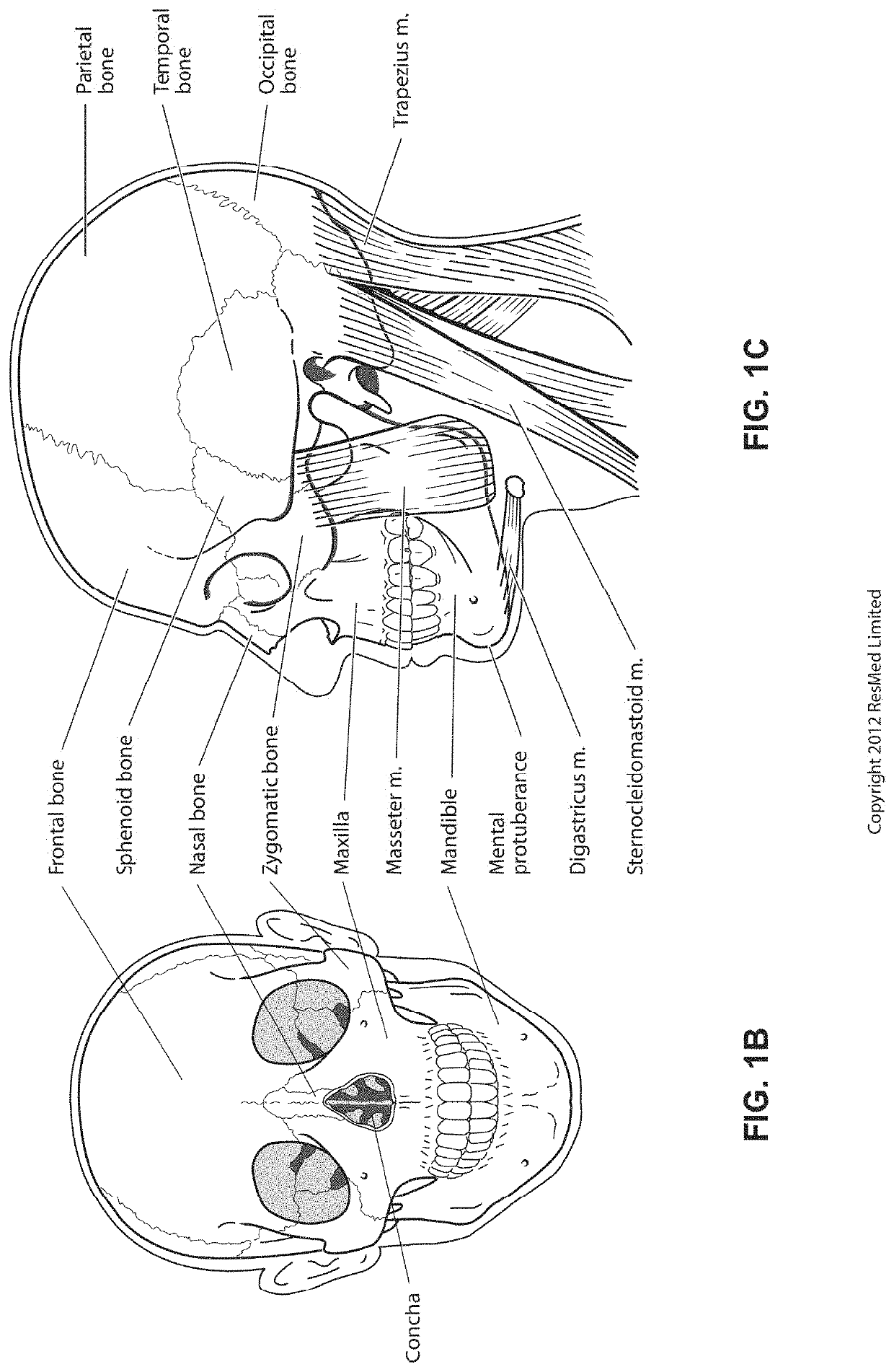 Positioning and stabilising structure and system incorporating same