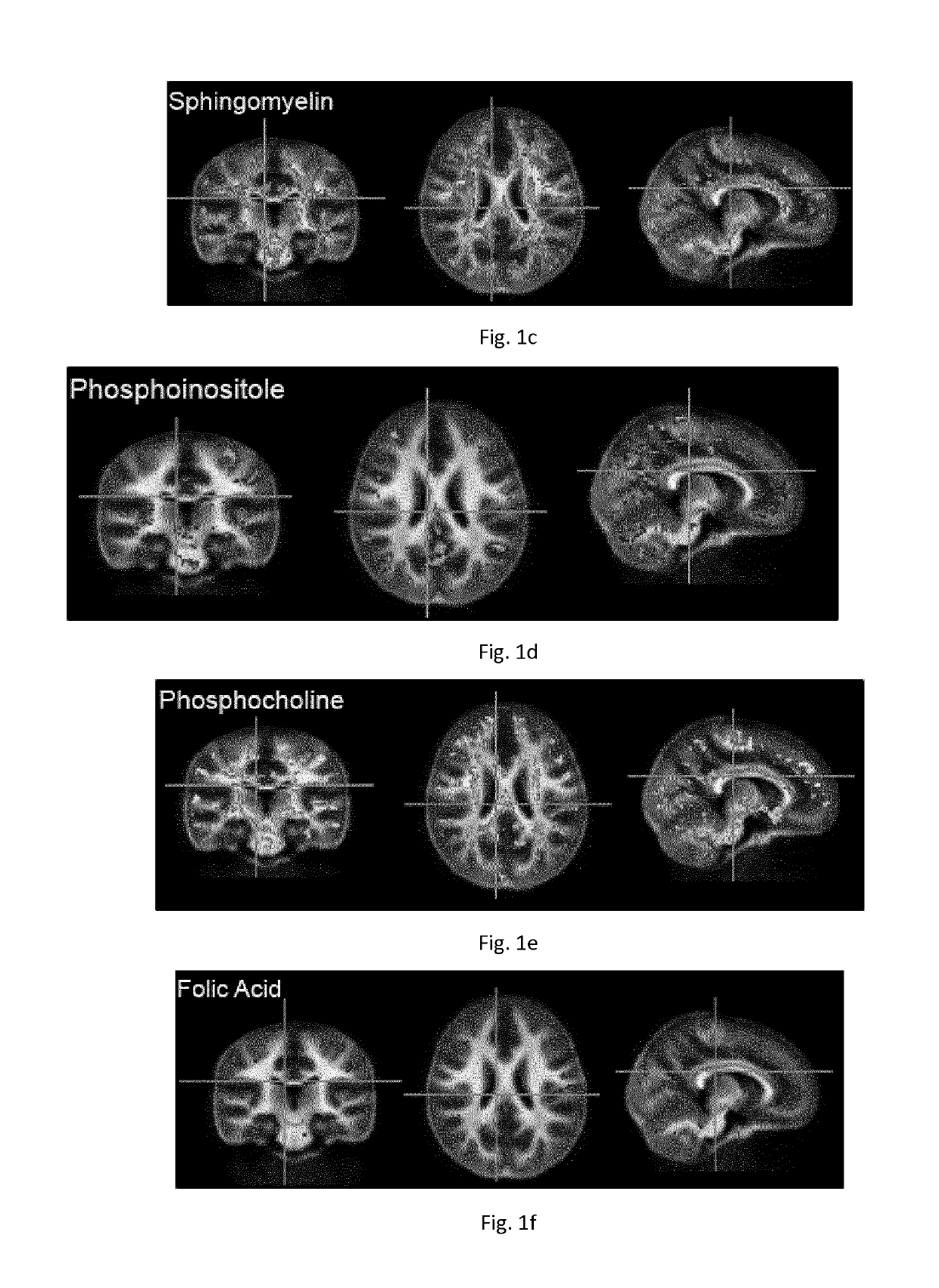 Nutritional composition and infant formula for promoting myelination of the brain