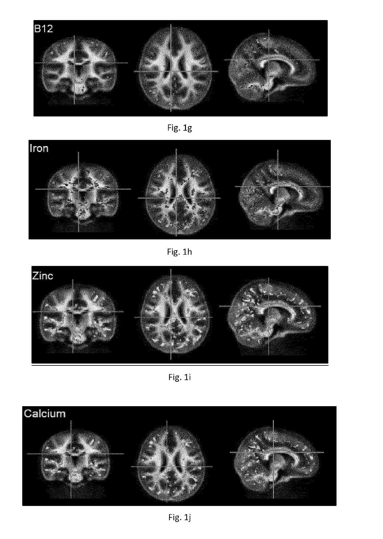 Nutritional composition and infant formula for promoting myelination of the brain