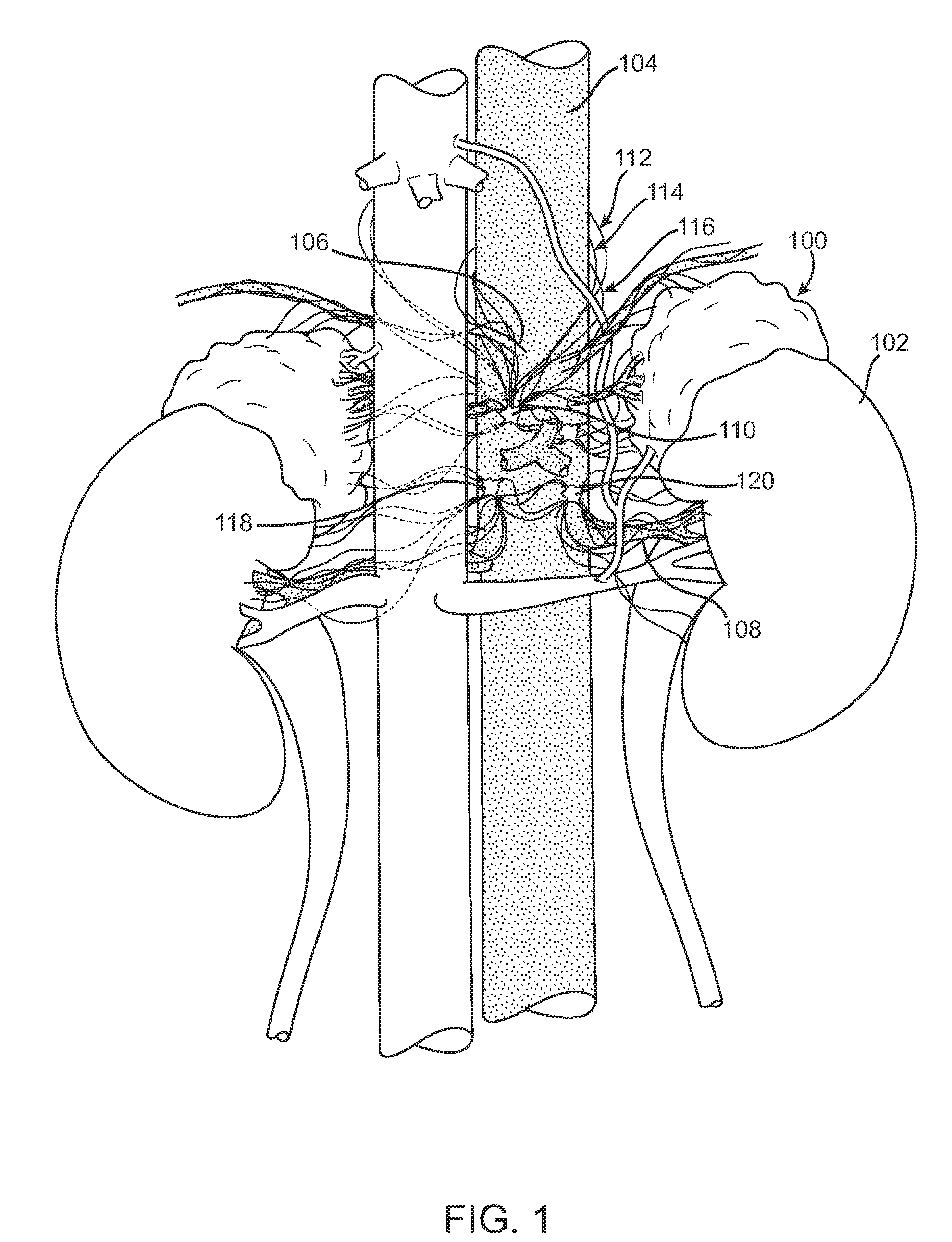 Method and Devices for Adrenal Stimulation