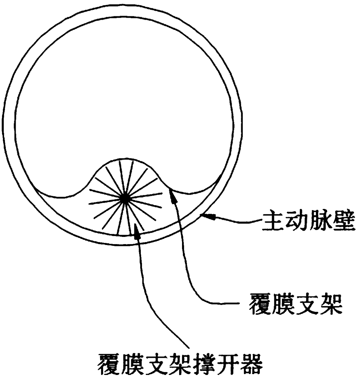 Film-covered stent expander