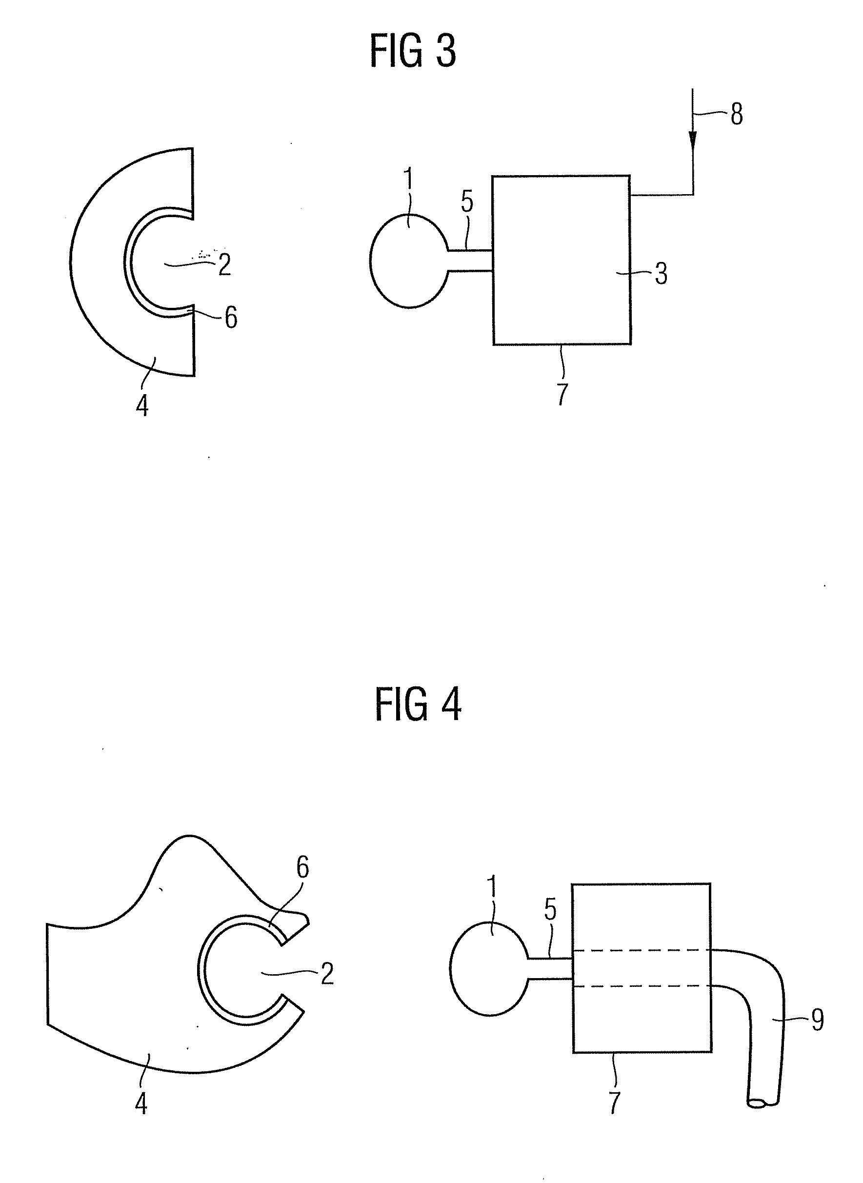 Ear mold for a hearing device
