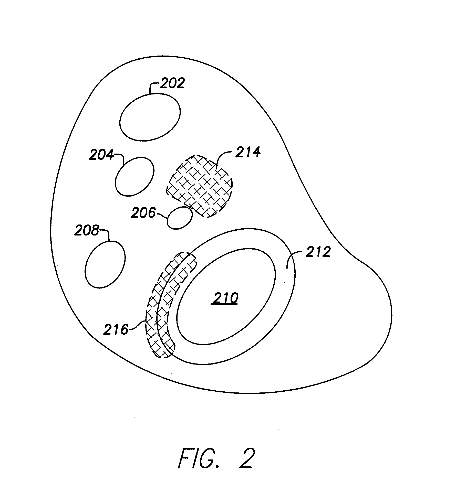 Leadless implantable medical device with dual chamber sensing functionality