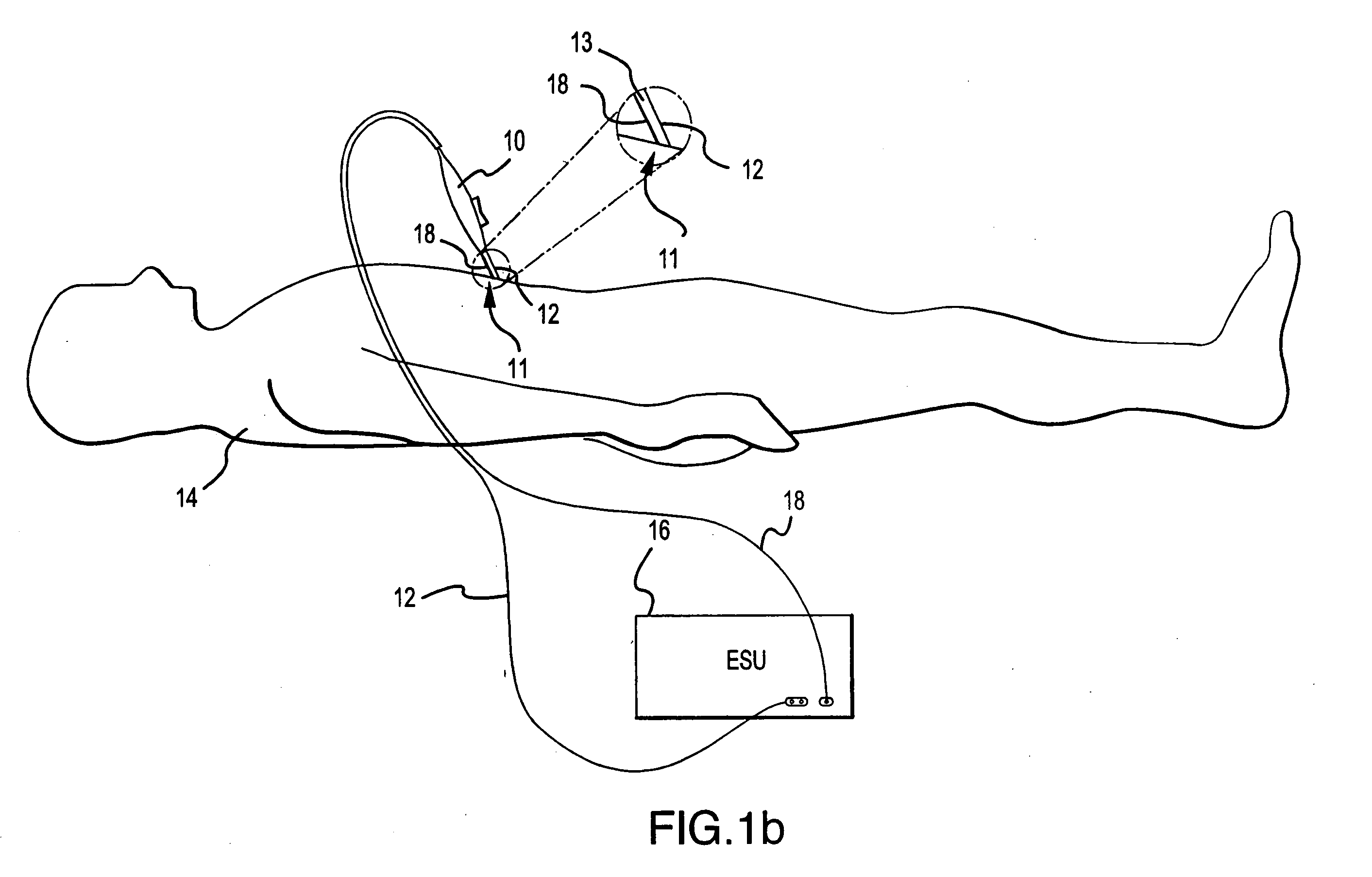 Multifunctional telescopic monopolar/bipolar surgical device and method therefore