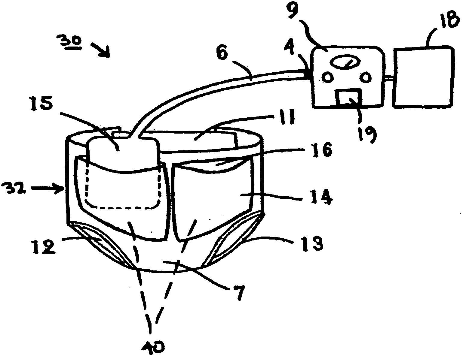 Apparatus for prevention and treatment of decubitus ulcers