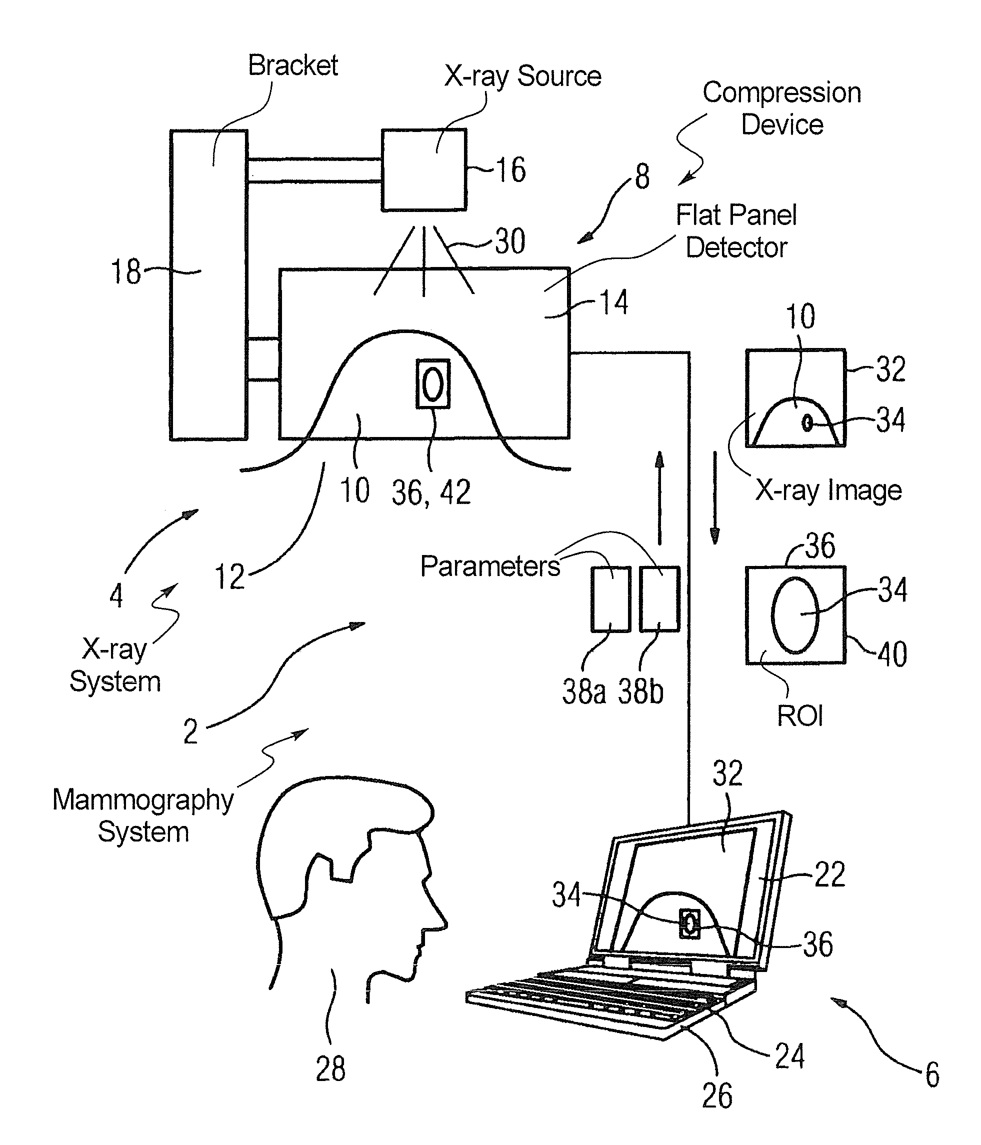 Method for producing an X-ray image during a mammography