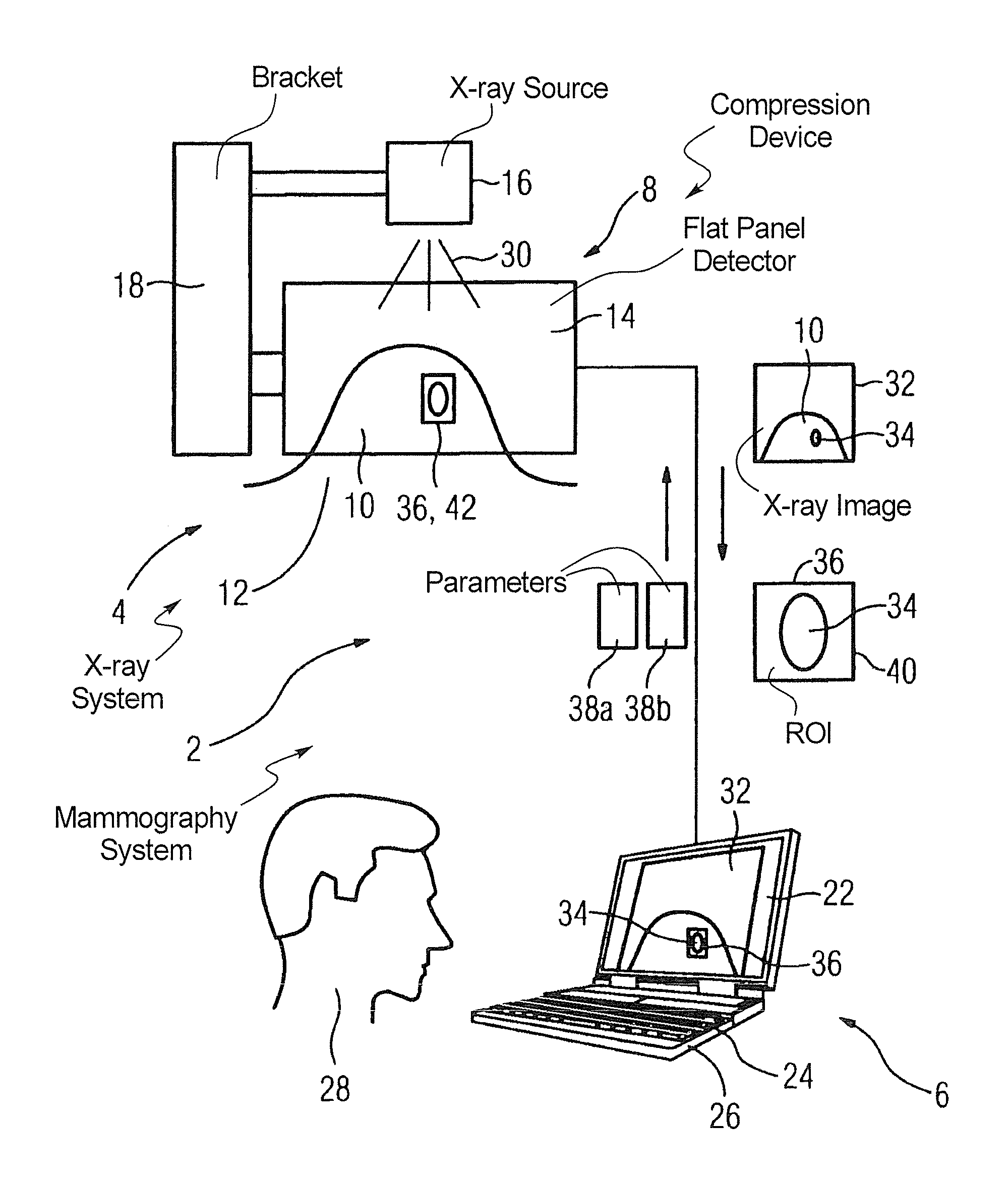 Method for producing an X-ray image during a mammography
