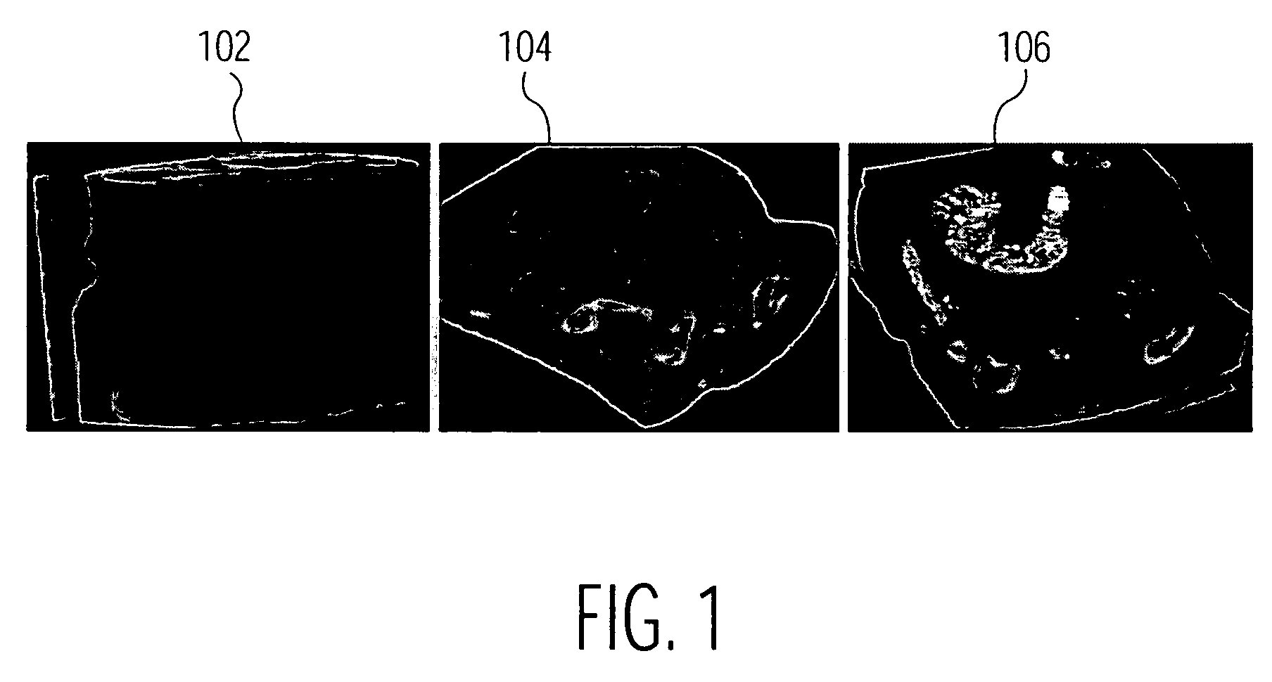 System and method for using learned discriminative models to segment three dimensional colon image data