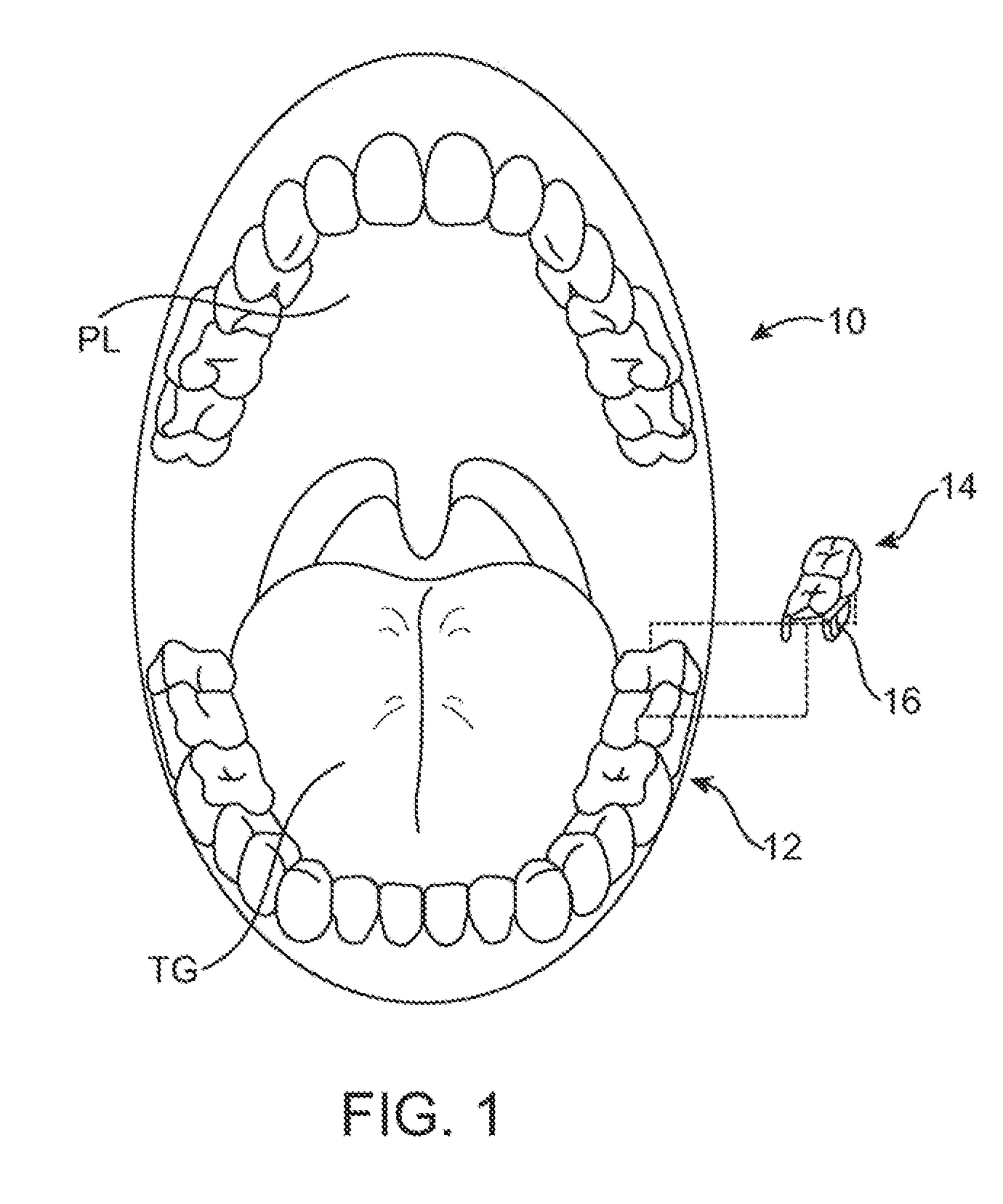 Methods and systems for tinnitus treatment